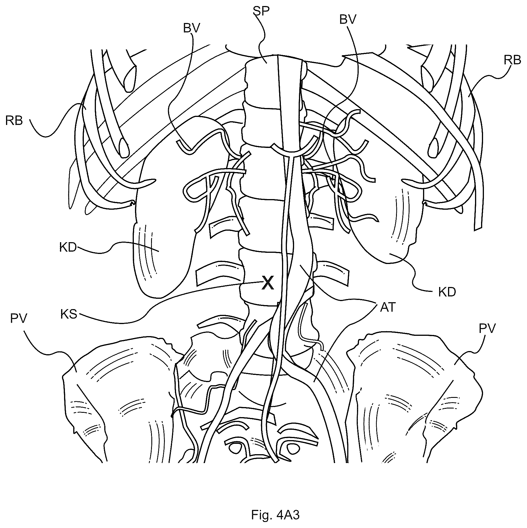 Patent US12620112 Figure 6 – Subsurface imaging and display of 3D digital image and 3D image sequence