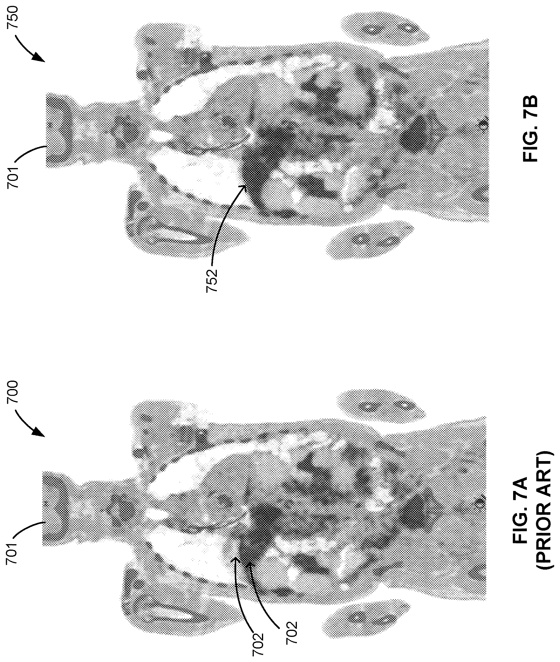 Patent US12620153 Figure 7 – Methods and apparatus for reconstruction, adjustment and display of medical images based on displacement vector field data generated by a trained machine learning process