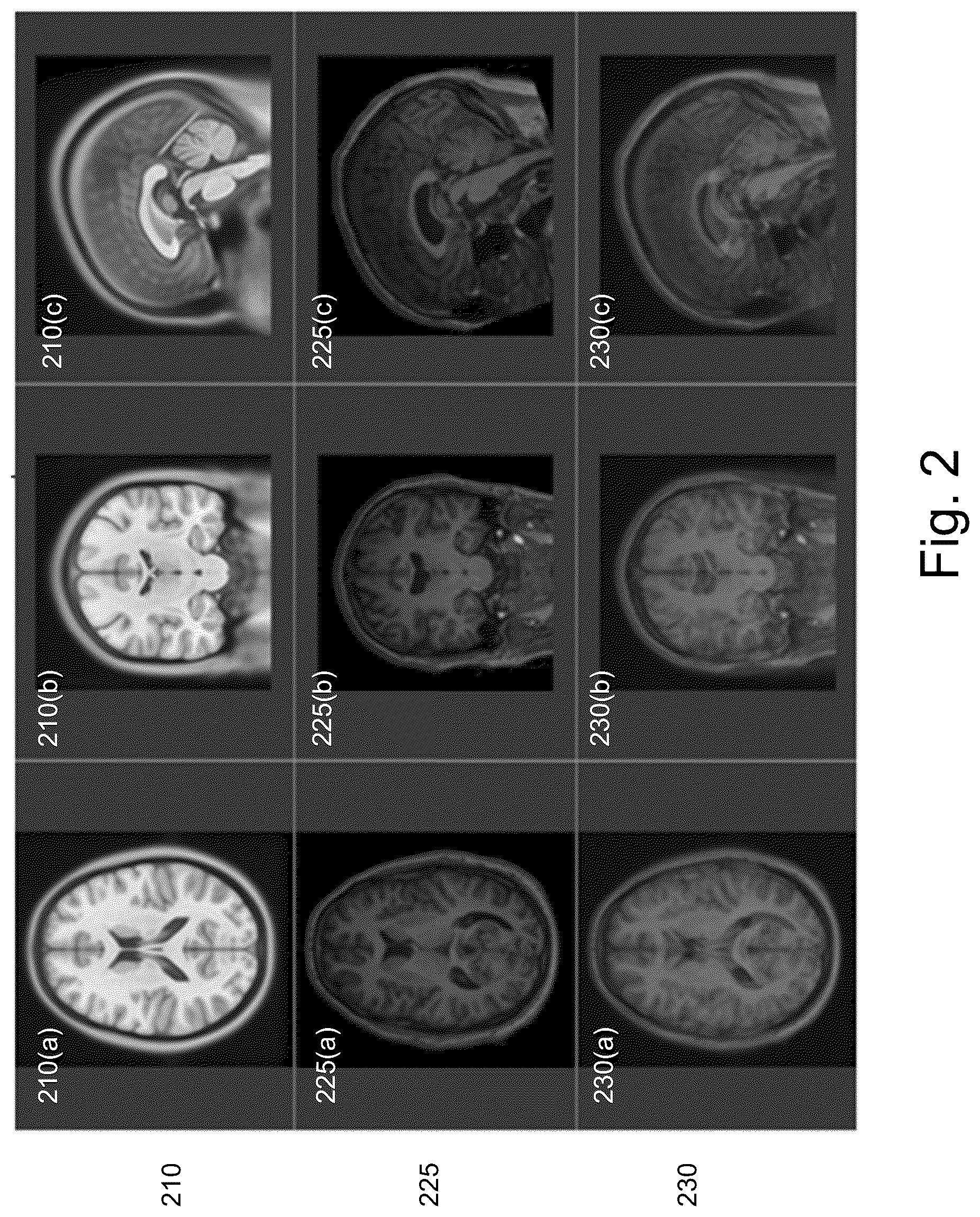 Patent US12620169 Figure 2 – Dense non-rigid volumetric mapping of image coordinates using sparse surface-based correspondences