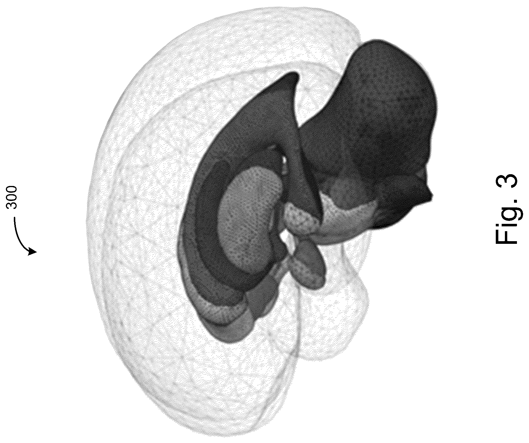 Patent US12620169 Figure 3 – Dense non-rigid volumetric mapping of image coordinates using sparse surface-based correspondences