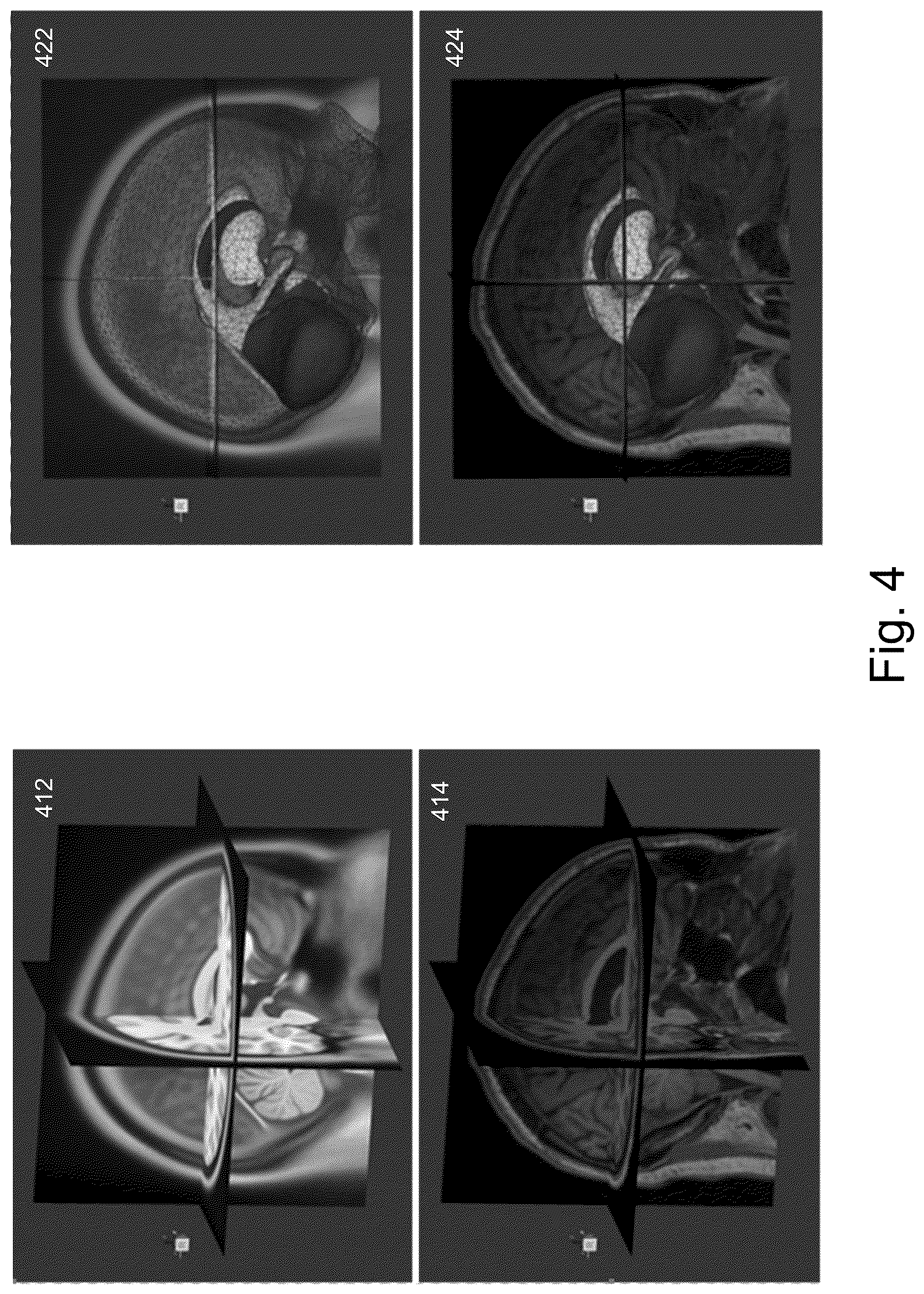 Patent US12620169 Figure 4 – Dense non-rigid volumetric mapping of image coordinates using sparse surface-based correspondences