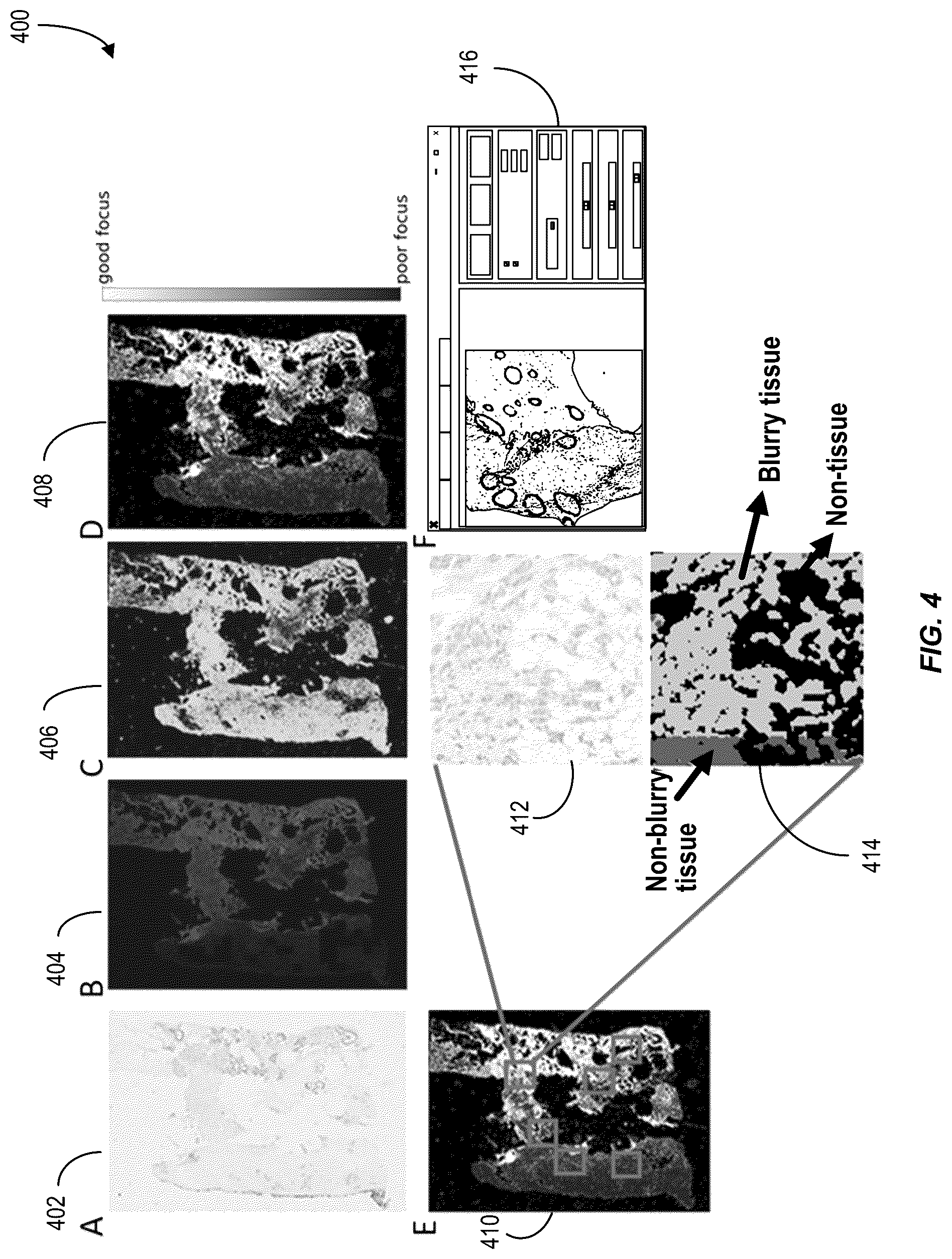 Patent US12620210 Figure 4 – Machine-learning techniques for detecting artifact pixels in images