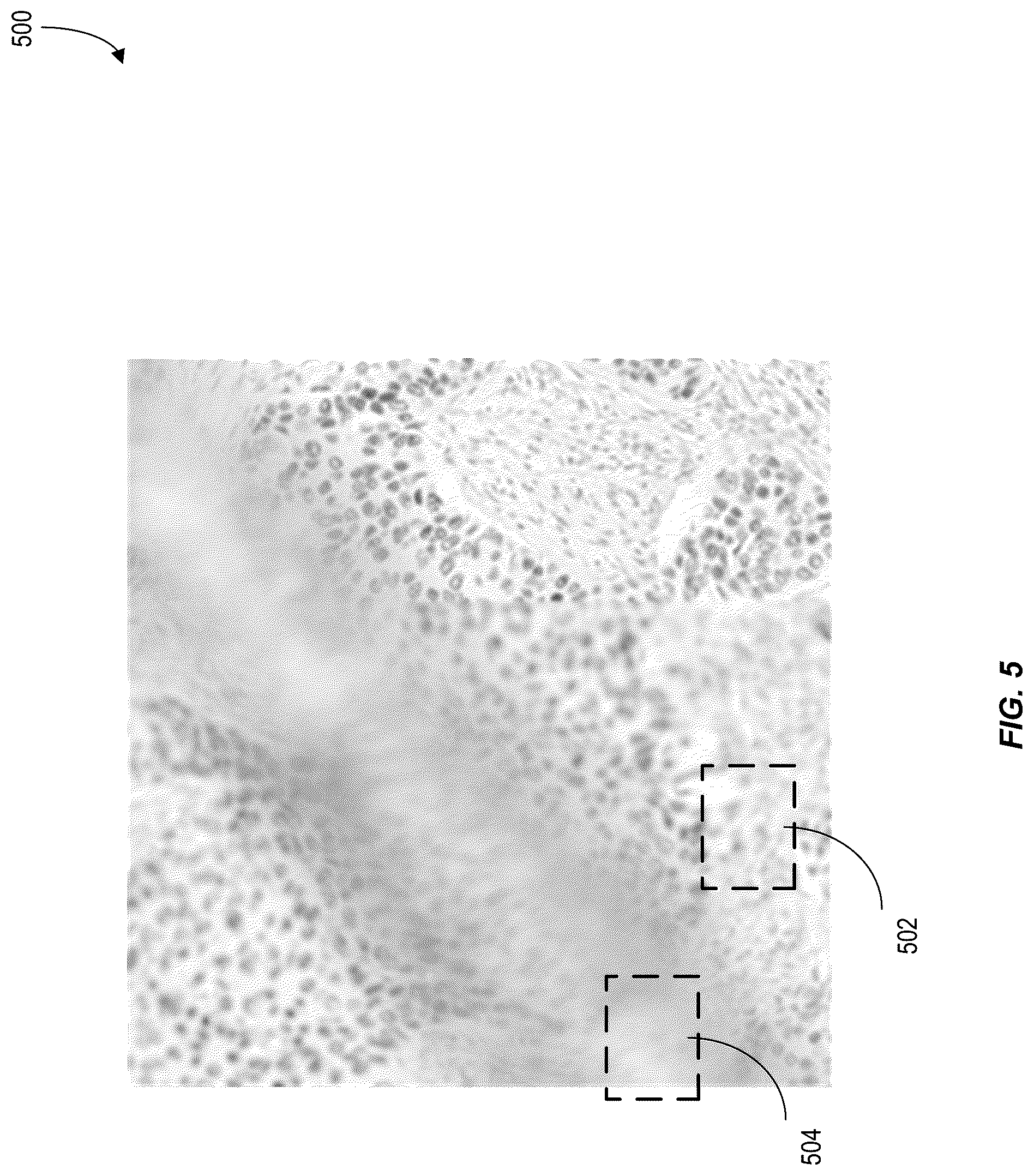 Patent US12620210 Figure 5 – Machine-learning techniques for detecting artifact pixels in images