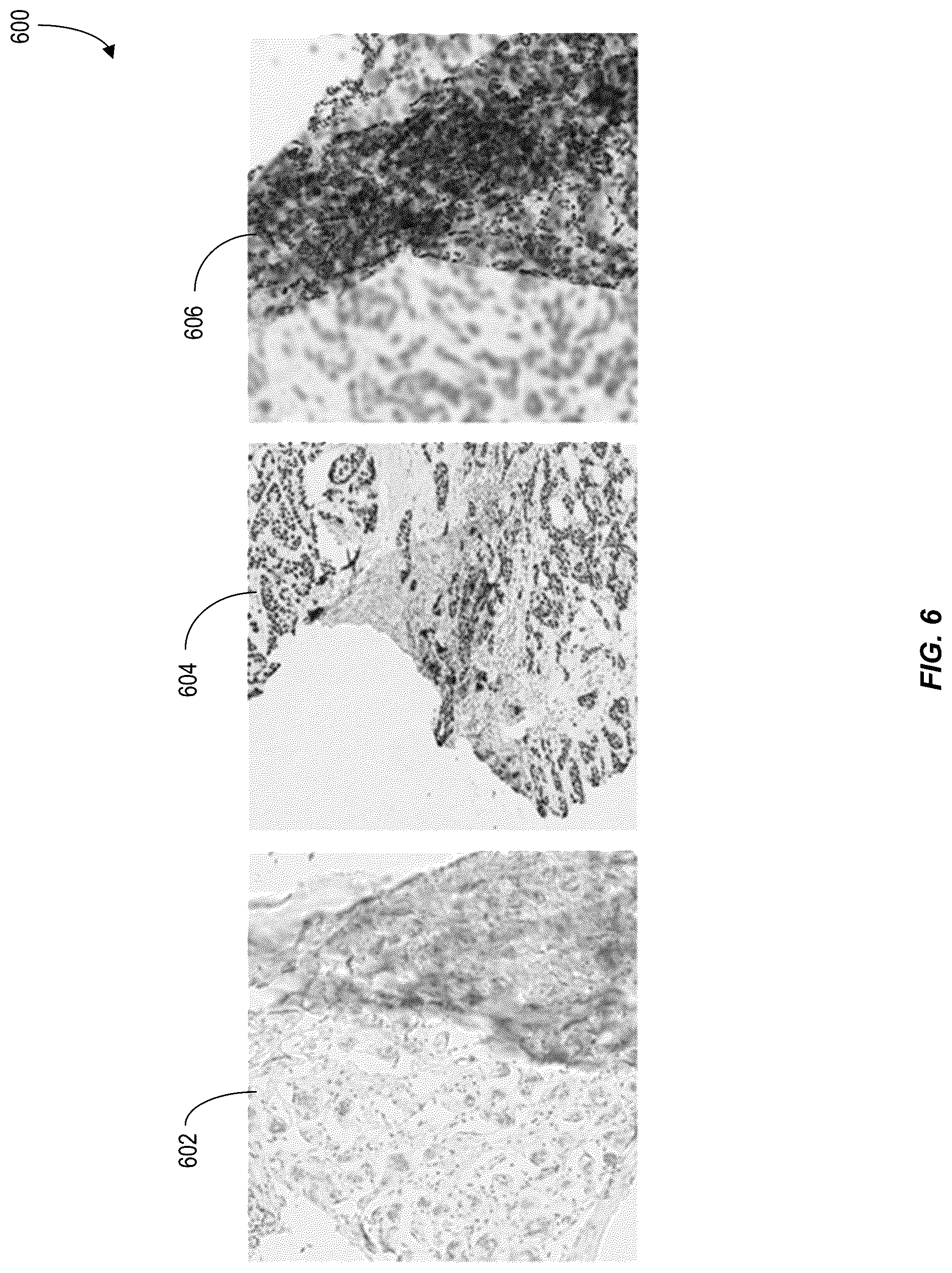 Patent US12620210 Figure 6 – Machine-learning techniques for detecting artifact pixels in images