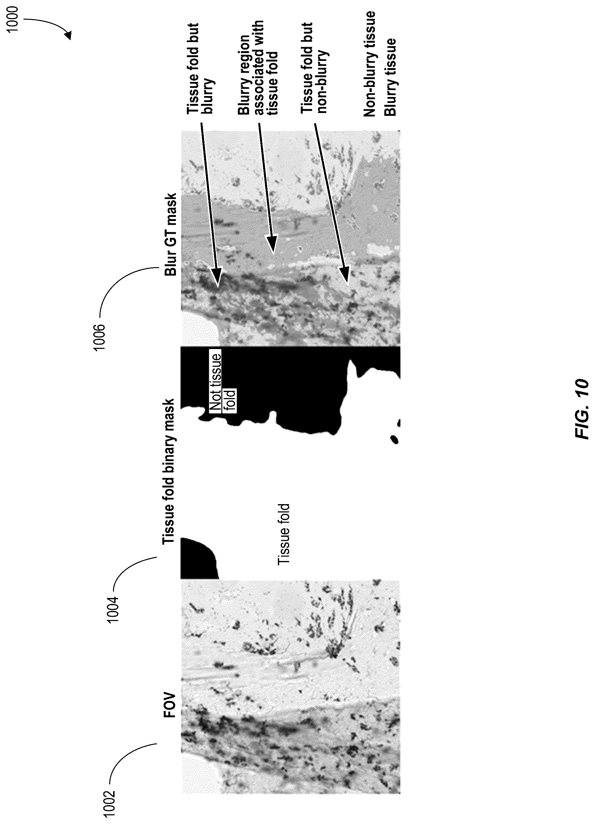 Patent US12620210 Figure 10 – Machine-learning techniques for detecting artifact pixels in images