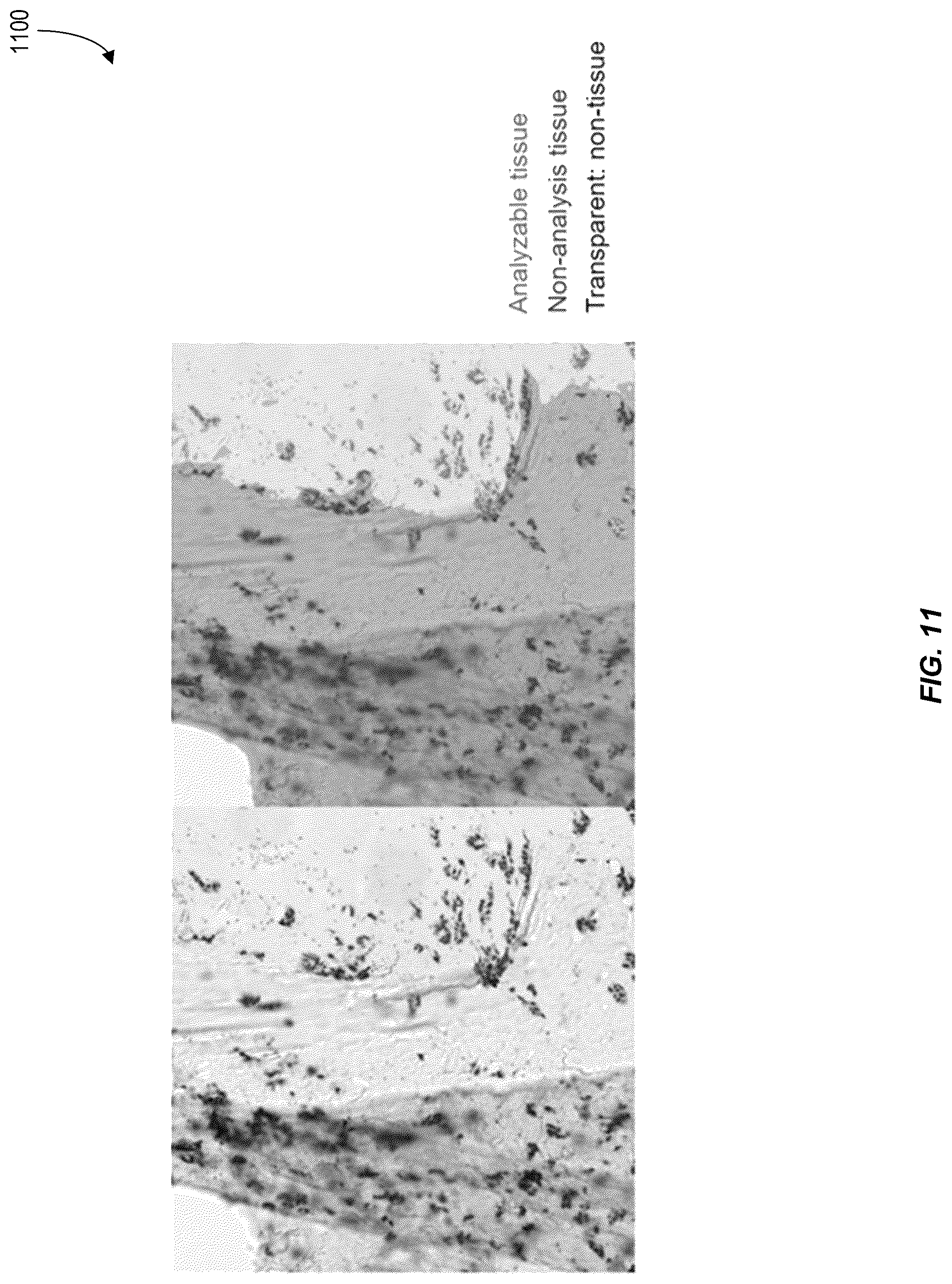 Patent US12620210 Figure 11 – Machine-learning techniques for detecting artifact pixels in images