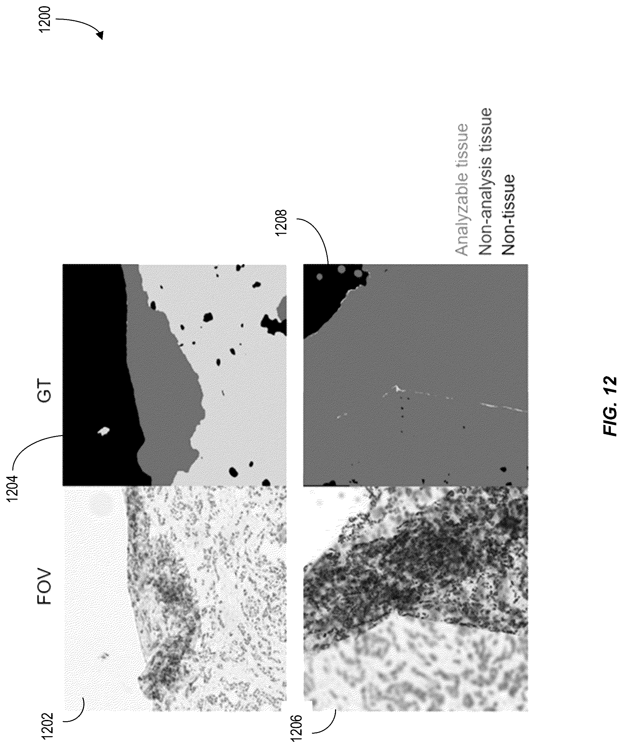 Patent US12620210 Figure 12 – Machine-learning techniques for detecting artifact pixels in images