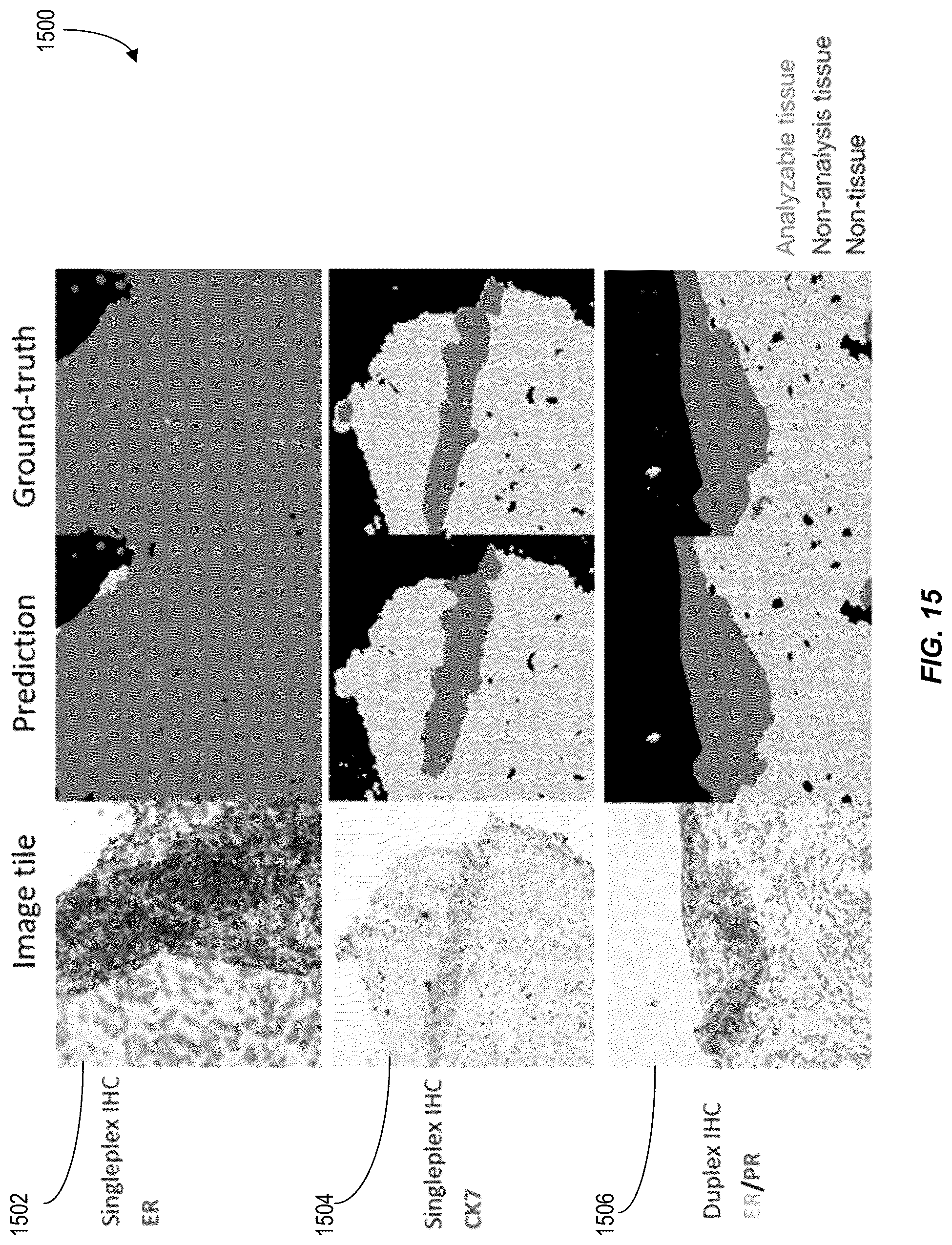 Patent US12620210 Figure 15 – Machine-learning techniques for detecting artifact pixels in images