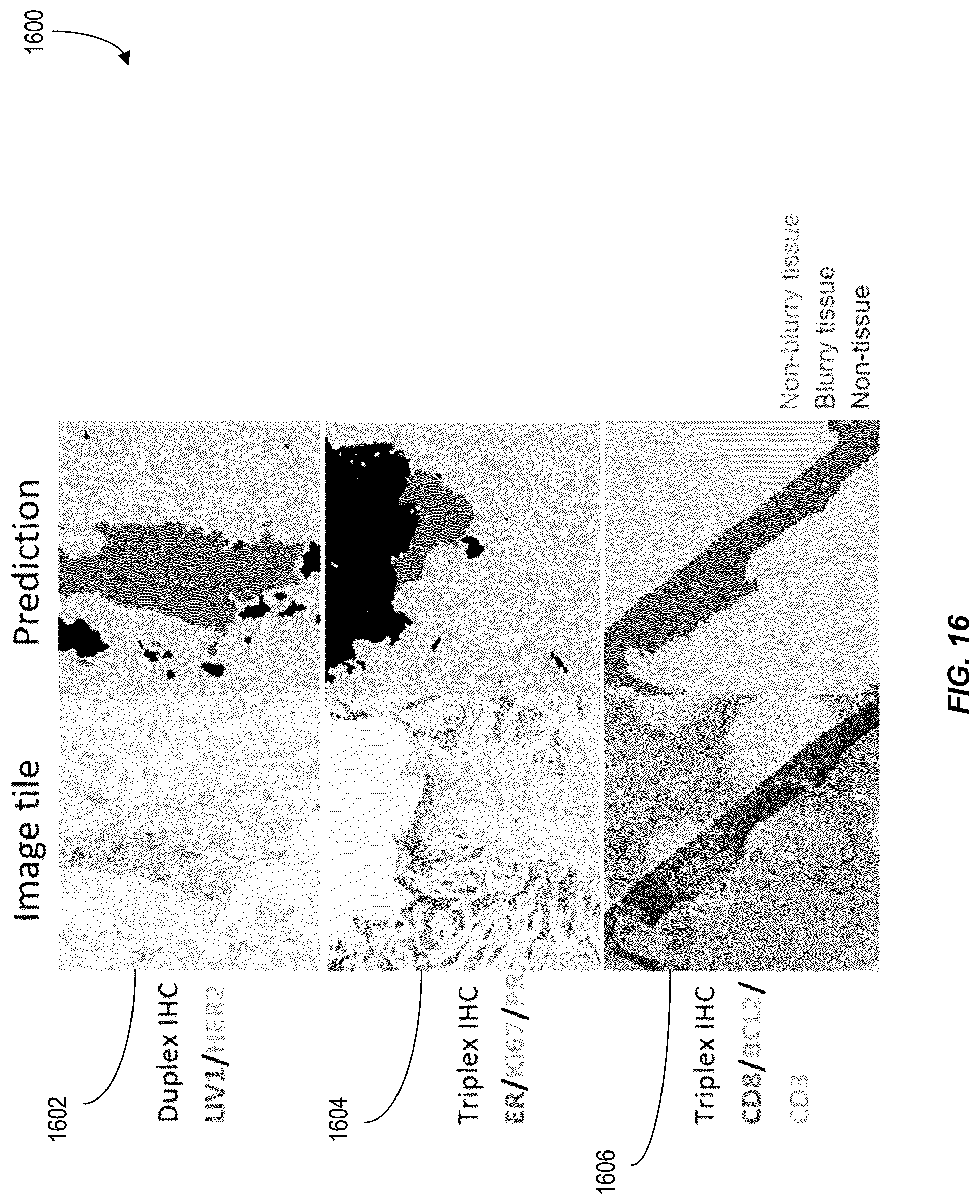 Patent US12620210 Figure 16 – Machine-learning techniques for detecting artifact pixels in images