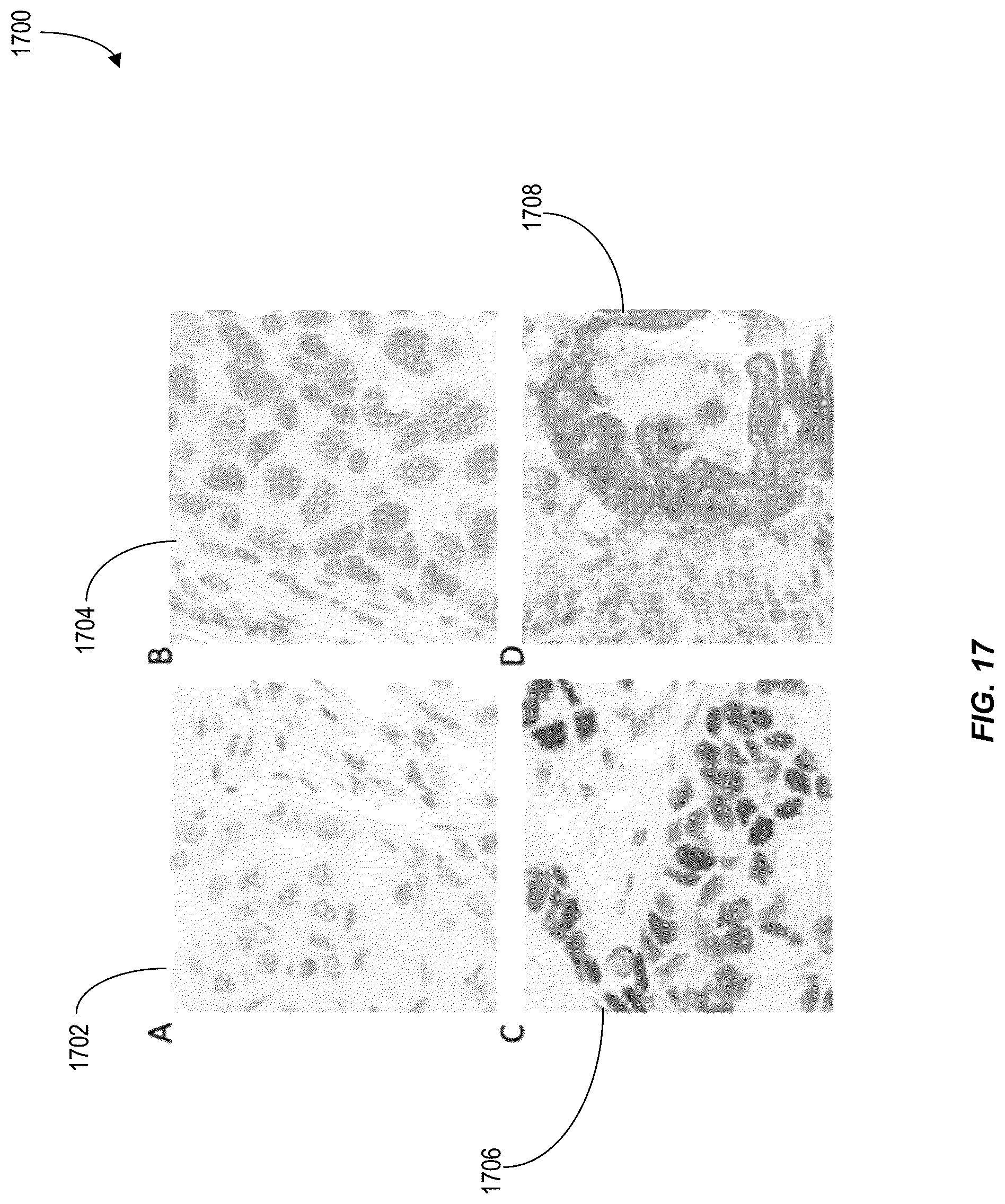Patent US12620210 Figure 17 – Machine-learning techniques for detecting artifact pixels in images