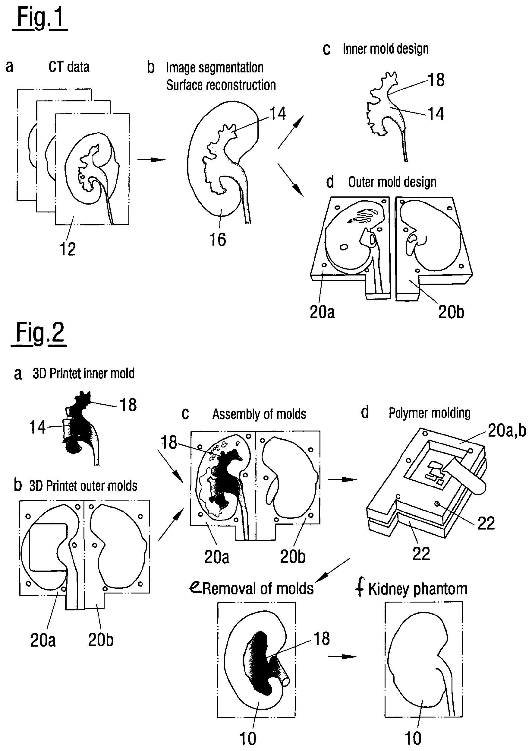 Patent US12620324 Figure 1 – Method of assessing the performance of a human or robot carrying out a medical procedure and assessment tool