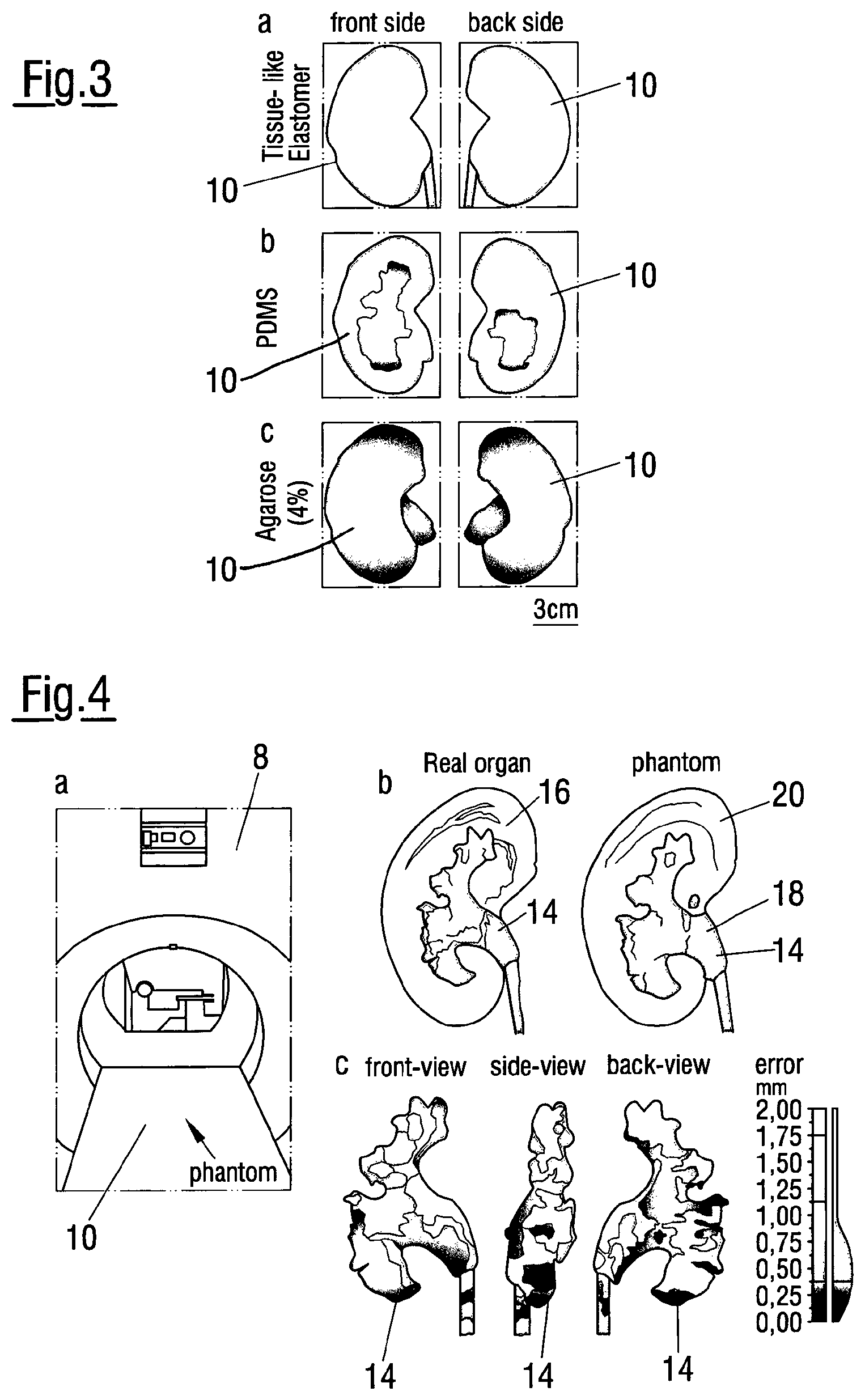 Patent US12620324 Figure 2 – Method of assessing the performance of a human or robot carrying out a medical procedure and assessment tool