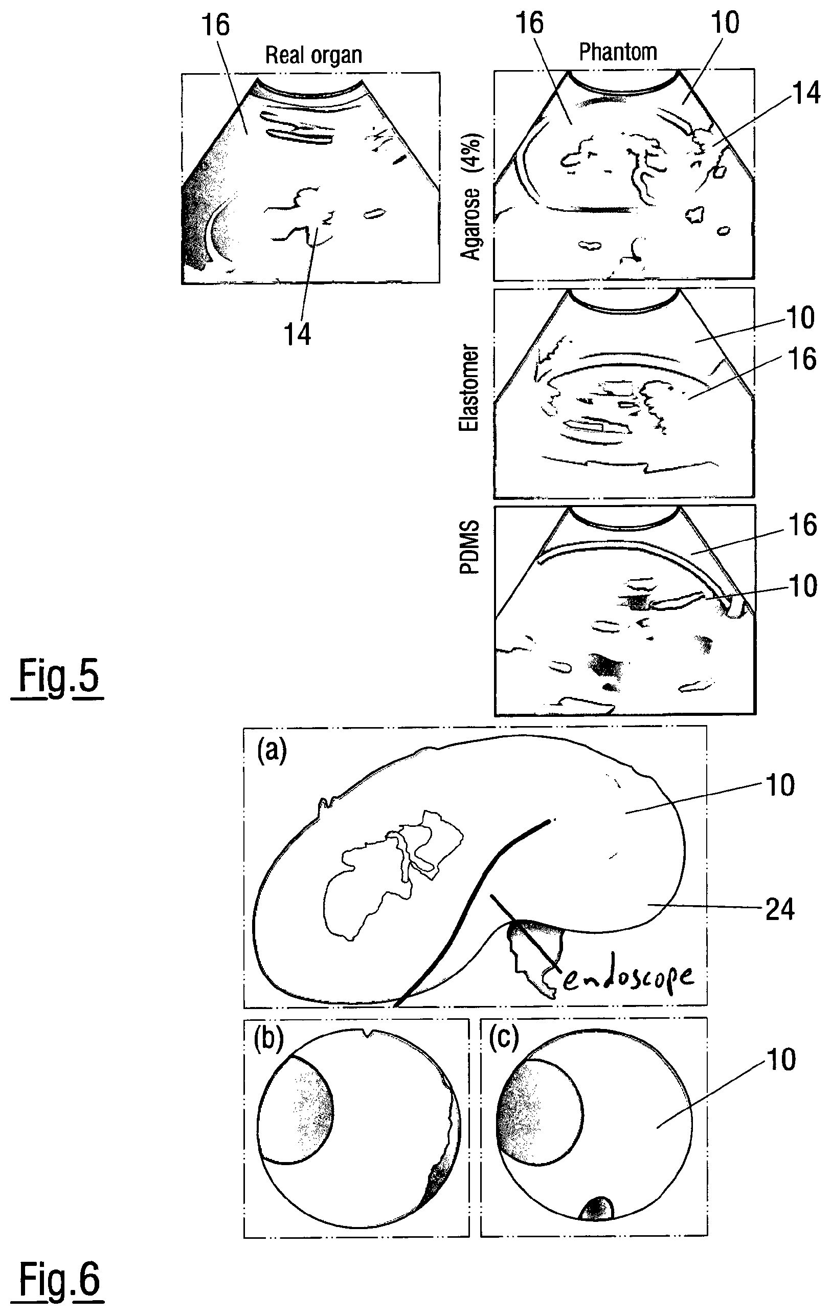 Patent US12620324 Figure 3 – Method of assessing the performance of a human or robot carrying out a medical procedure and assessment tool
