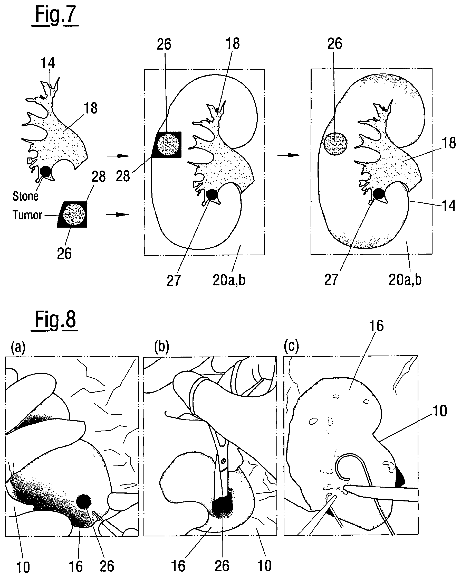 Patent US12620324 Figure 4 – Method of assessing the performance of a human or robot carrying out a medical procedure and assessment tool