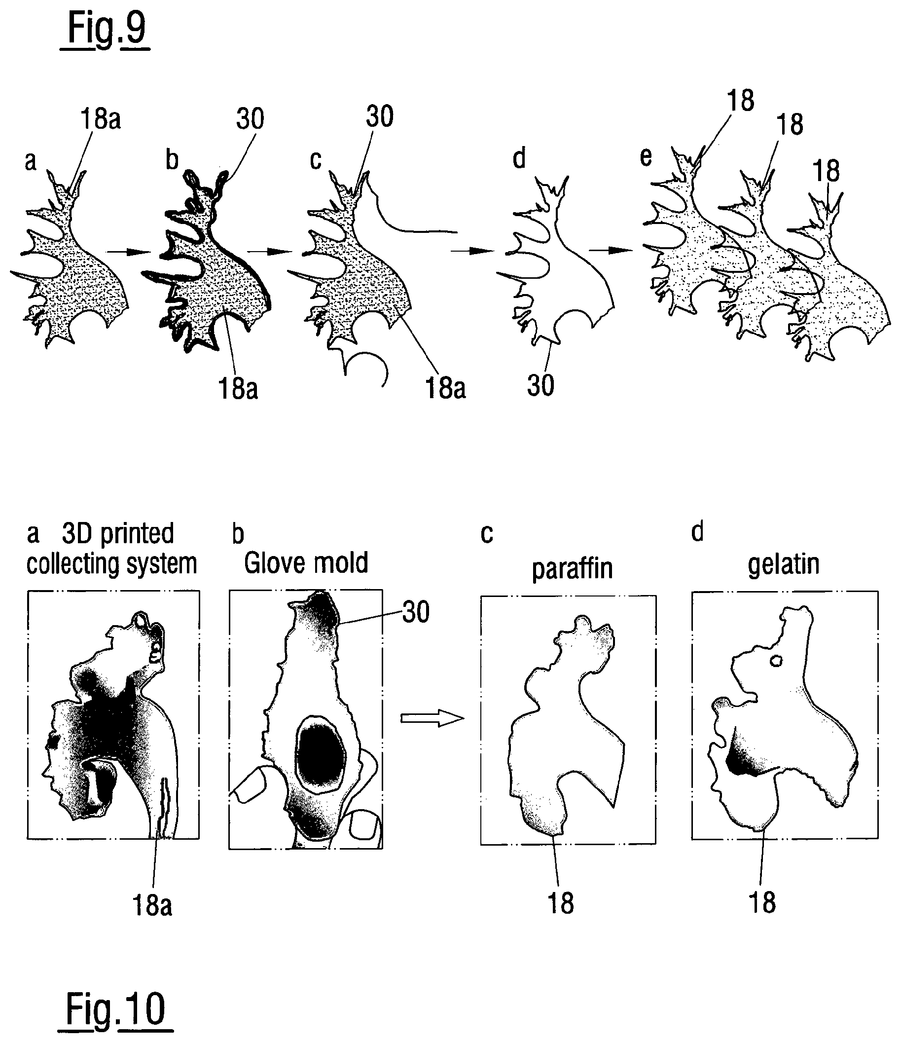 Patent US12620324 Figure 5 – Method of assessing the performance of a human or robot carrying out a medical procedure and assessment tool