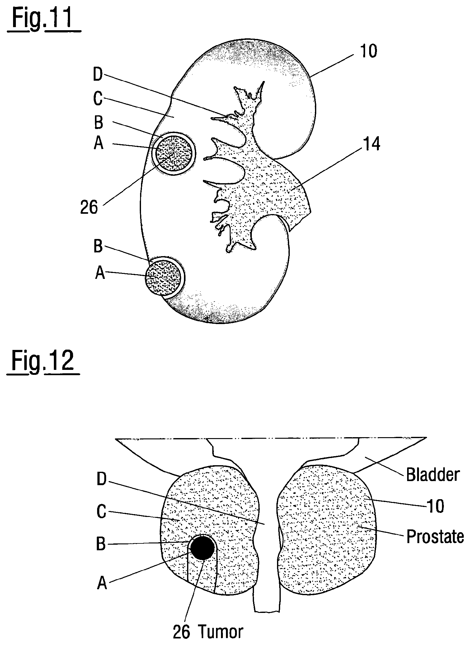 Patent US12620324 Figure 6 – Method of assessing the performance of a human or robot carrying out a medical procedure and assessment tool