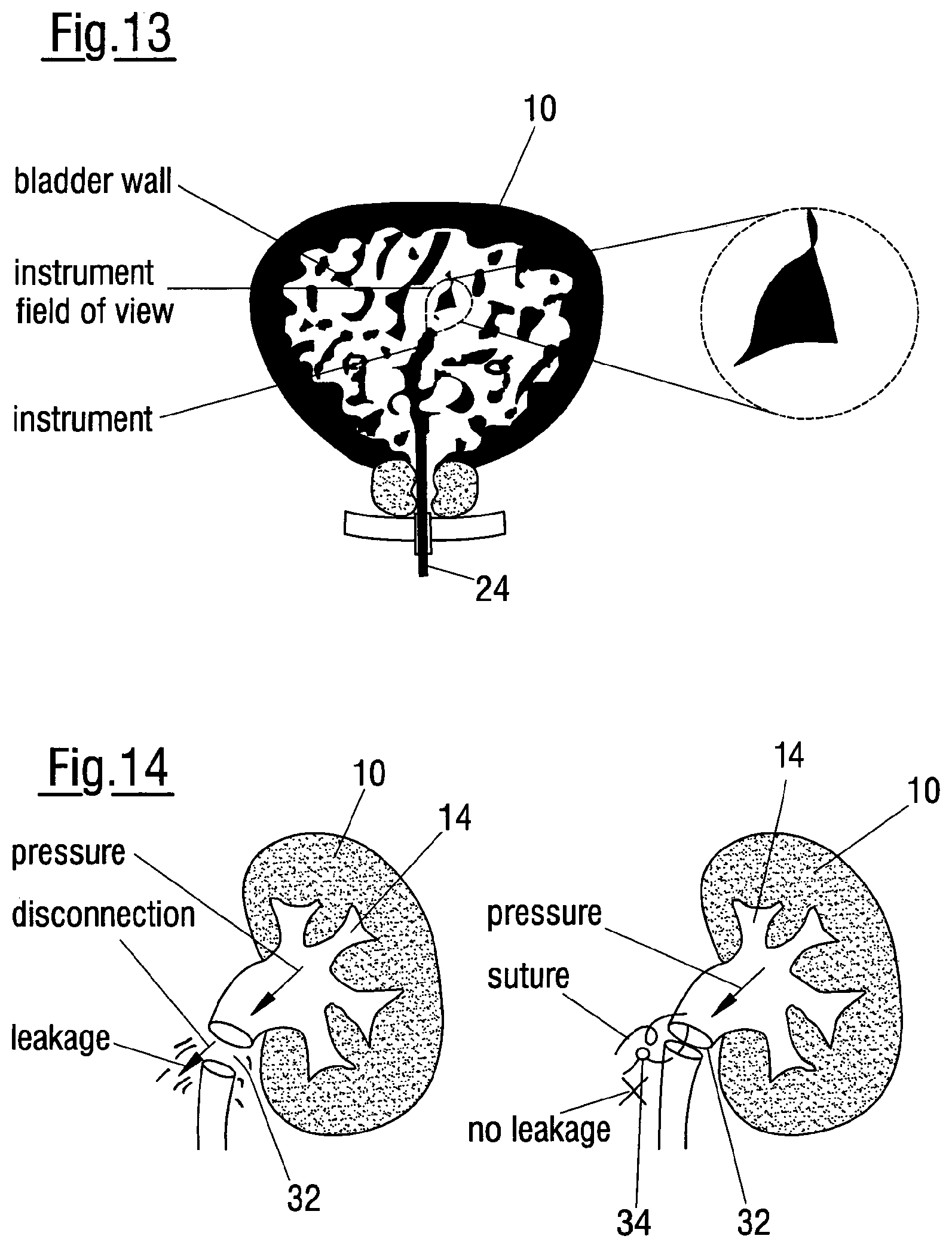 Patent US12620324 Figure 7 – Method of assessing the performance of a human or robot carrying out a medical procedure and assessment tool