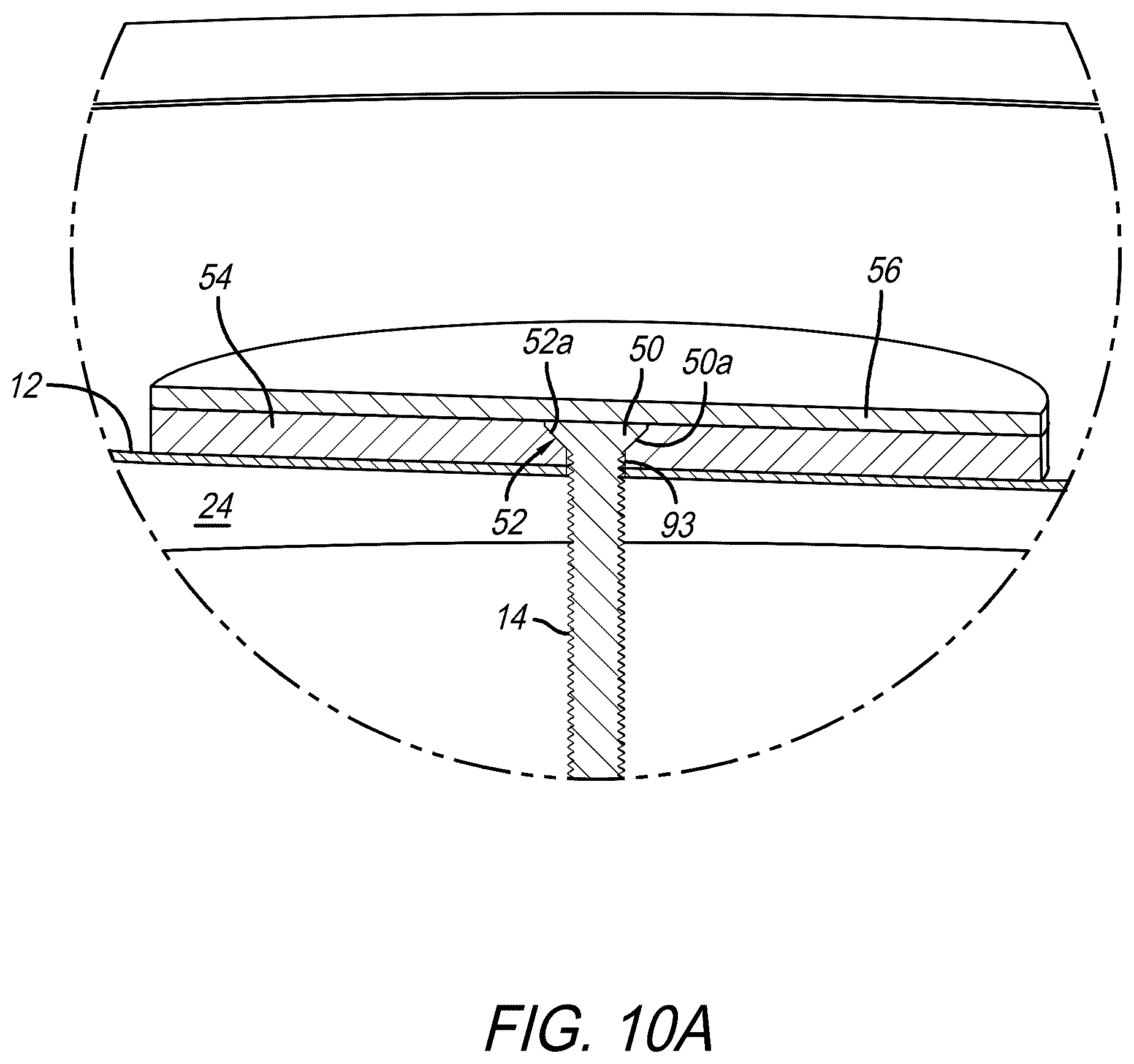 Patent US12620373 Figure 11 – Drumhead assembly and method of use