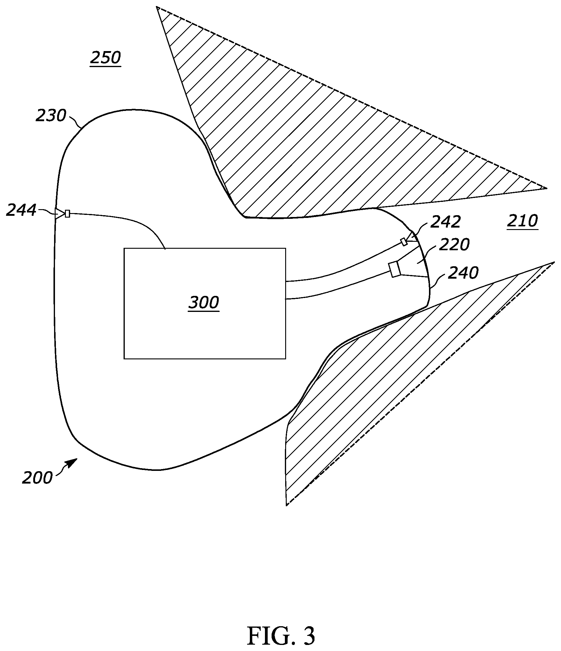 Patent US12620385 Figure 2 – Low latency audio processing system having active noise cancellation for ear-worn hearing device