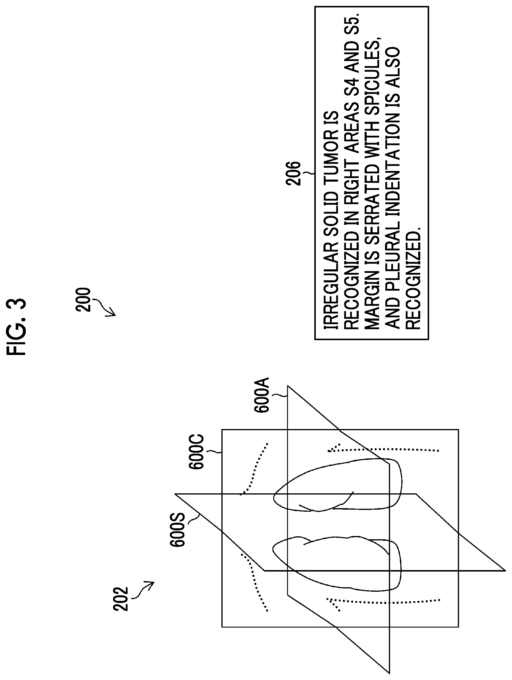 Patent US12620465 Figure 3 – Learning apparatus, learning method, trained model, and program
