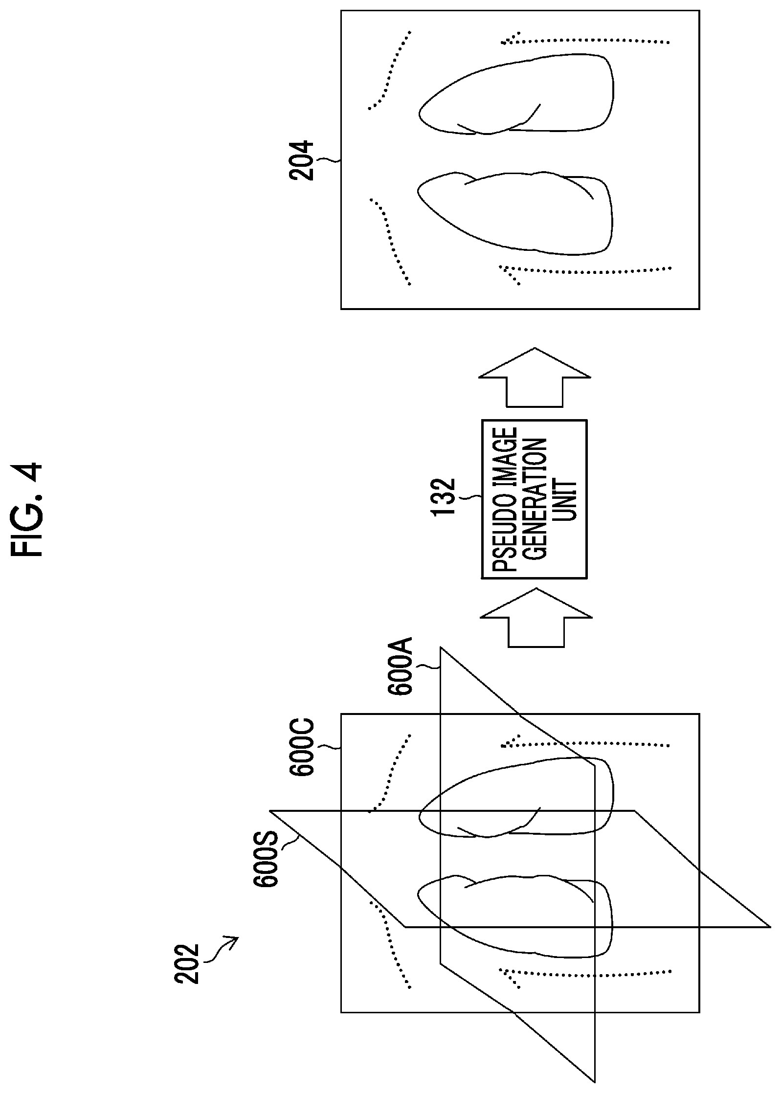 Patent US12620465 Figure 4 – Learning apparatus, learning method, trained model, and program