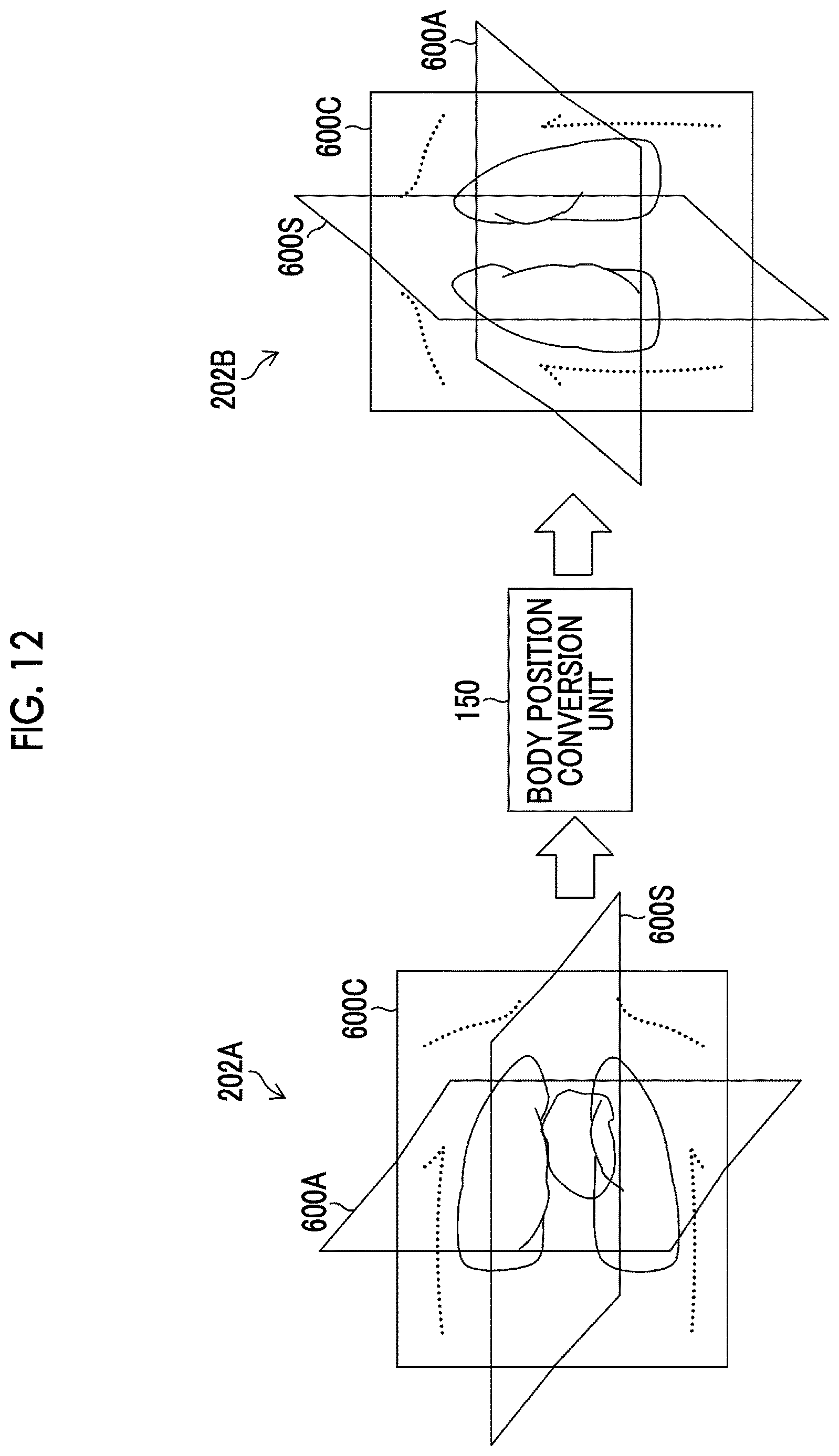 Patent US12620465 Figure 12 – Learning apparatus, learning method, trained model, and program