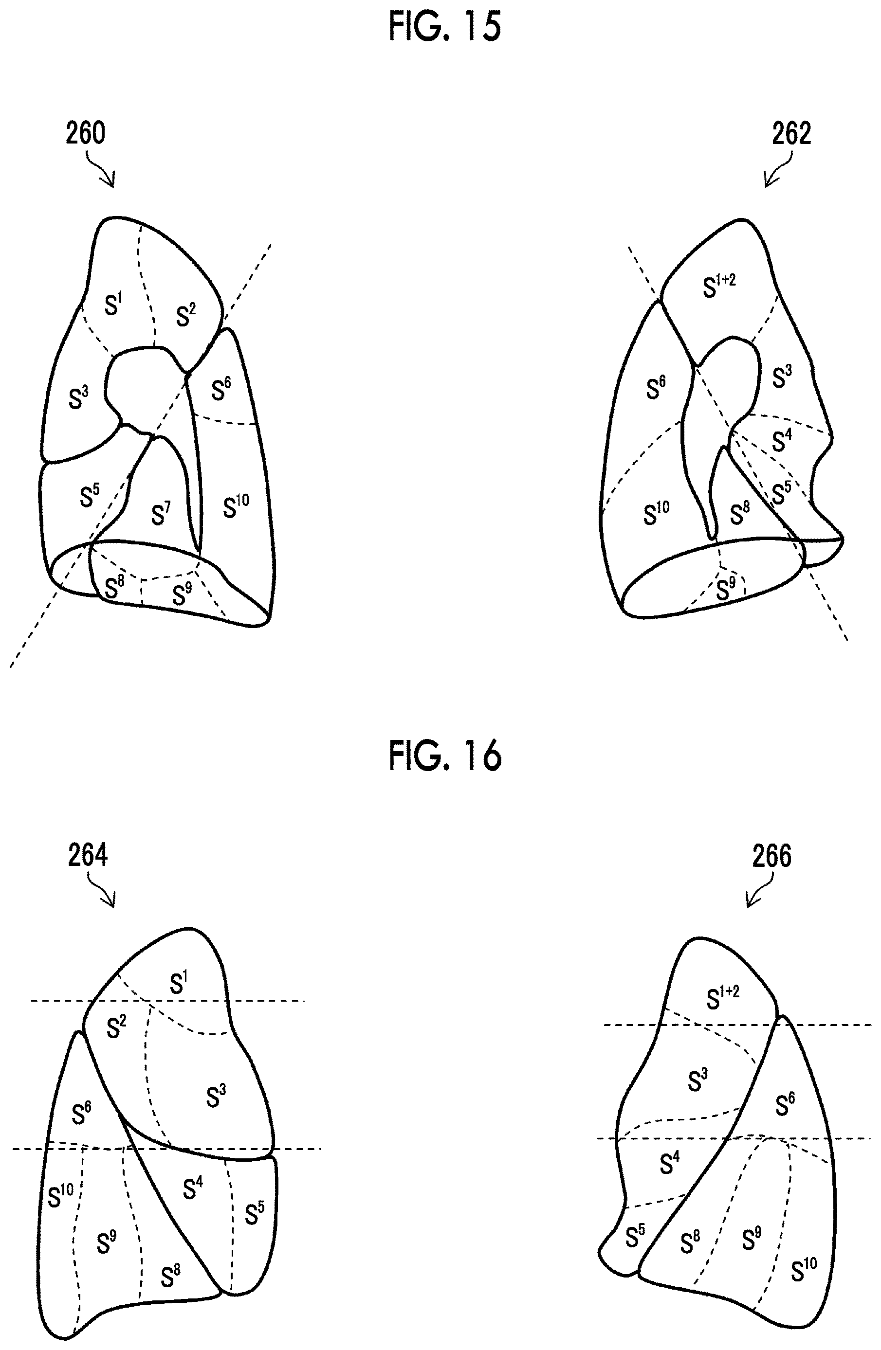 Patent US12620465 Figure 15 – Learning apparatus, learning method, trained model, and program