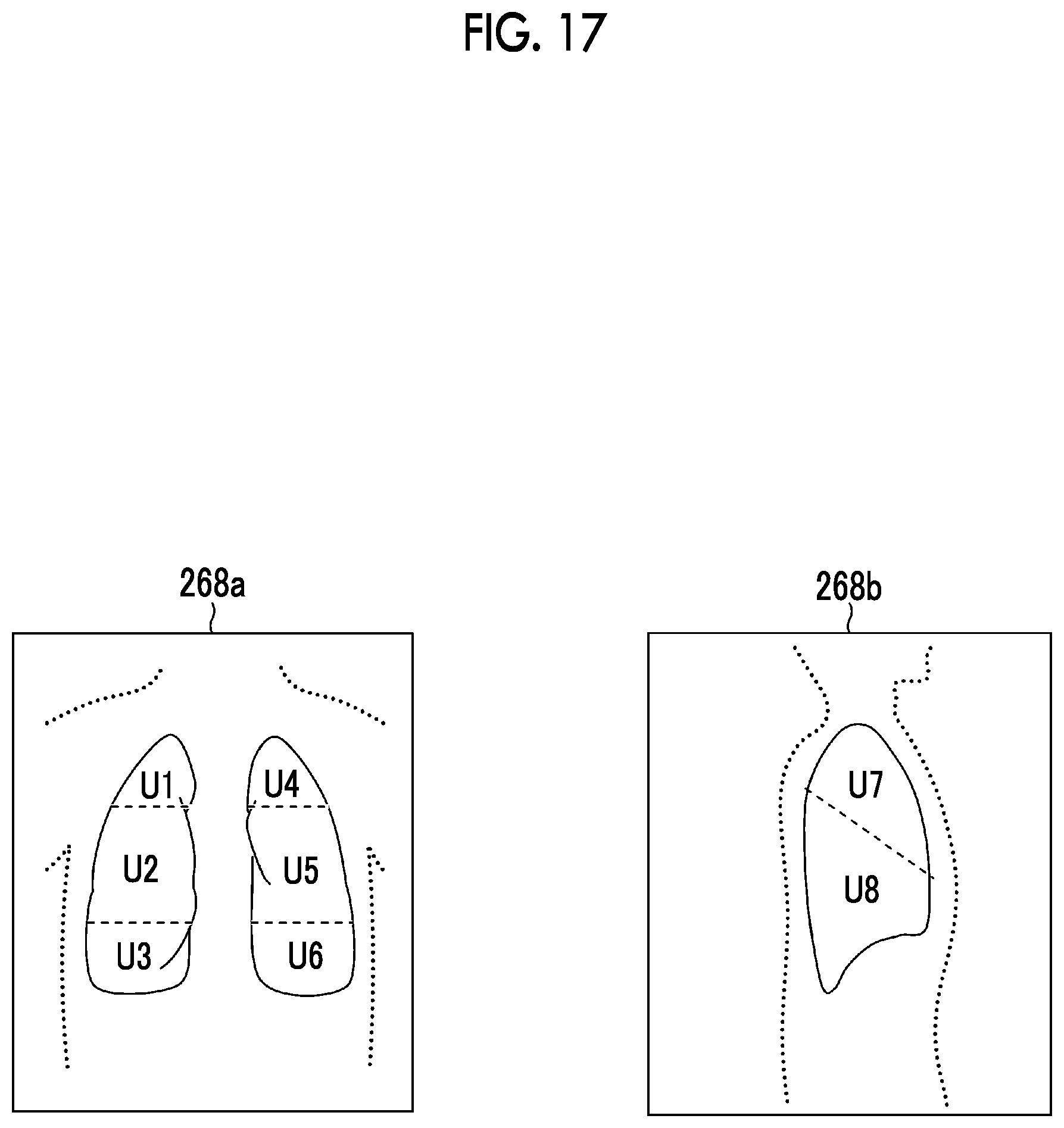 Patent US12620465 Figure 16 – Learning apparatus, learning method, trained model, and program