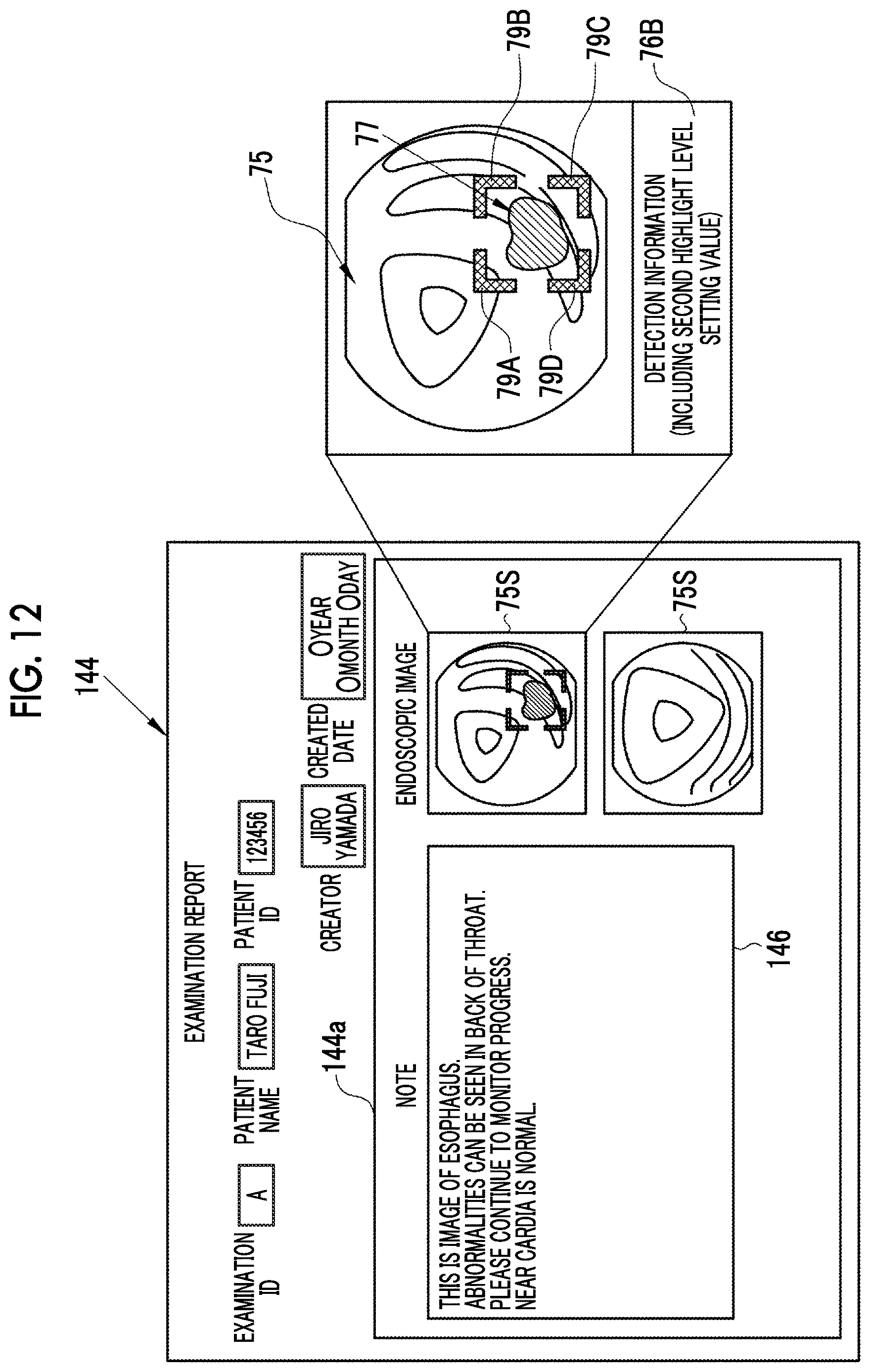 Patent US12620474 Figure 11 – Medical image processing apparatus, endoscope system, method of operating medical image processing apparatus, and non-transitory computer readable medium