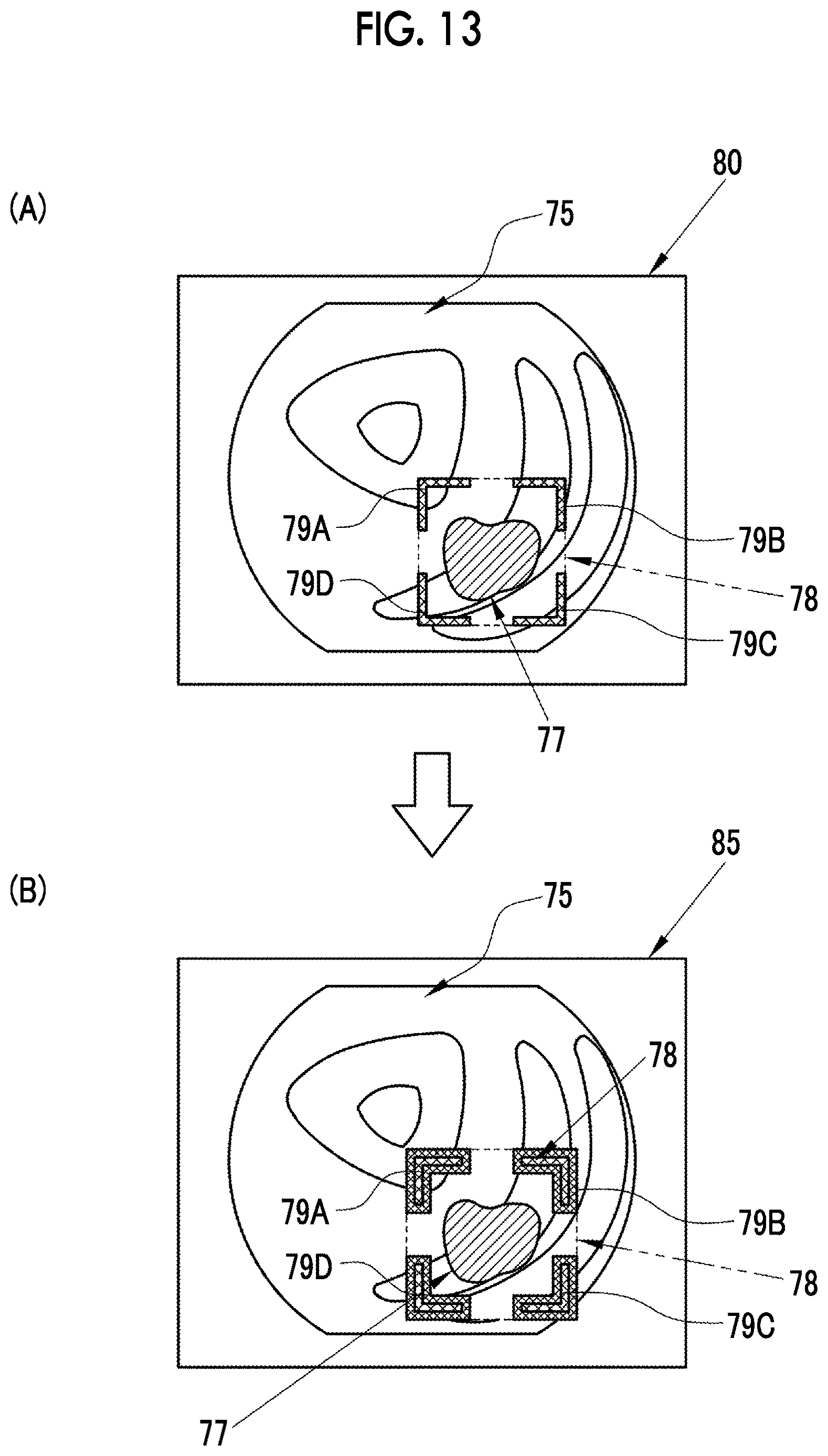 Patent US12620474 Figure 12 – Medical image processing apparatus, endoscope system, method of operating medical image processing apparatus, and non-transitory computer readable medium