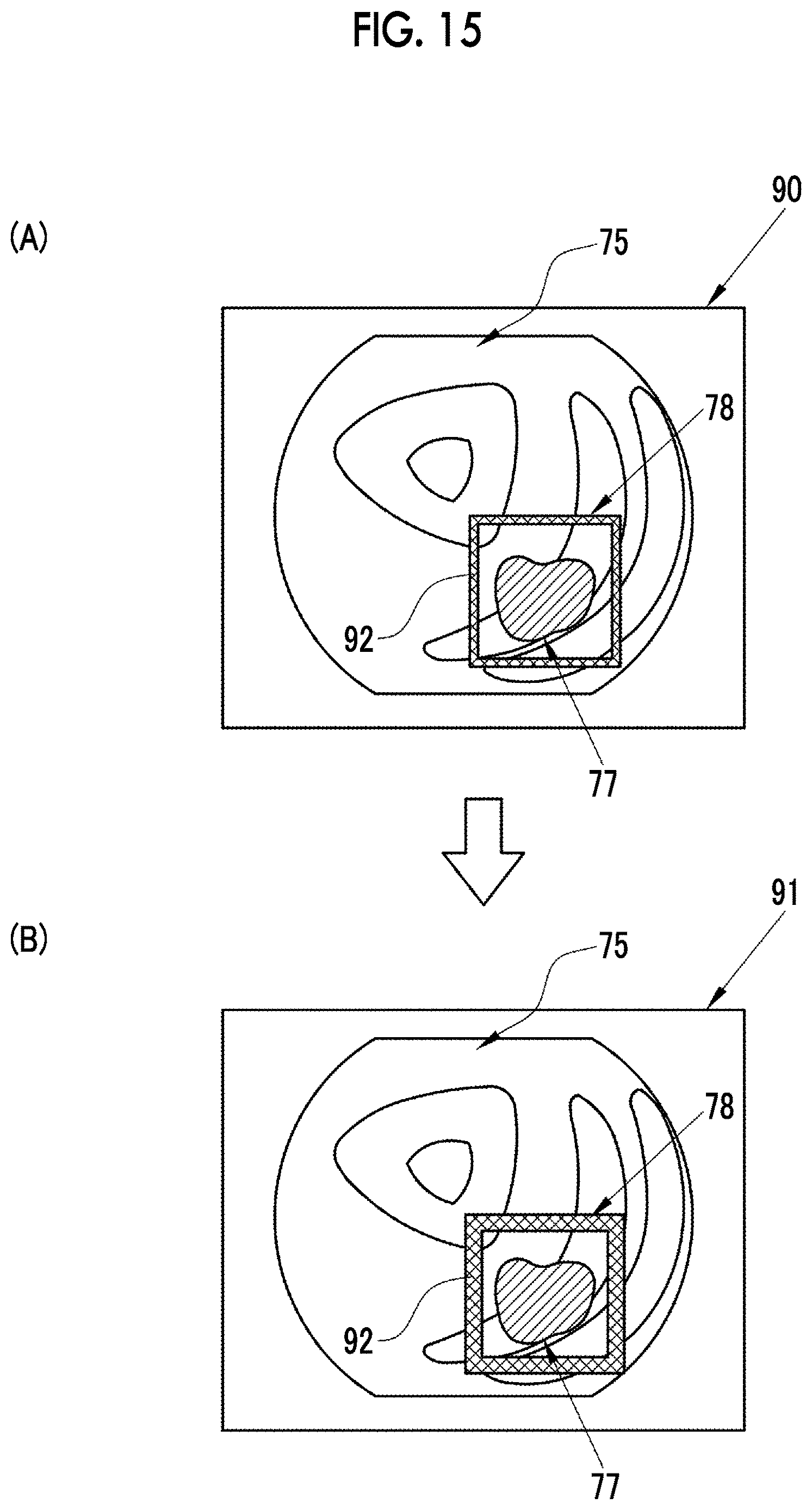 Patent US12620474 Figure 14 – Medical image processing apparatus, endoscope system, method of operating medical image processing apparatus, and non-transitory computer readable medium