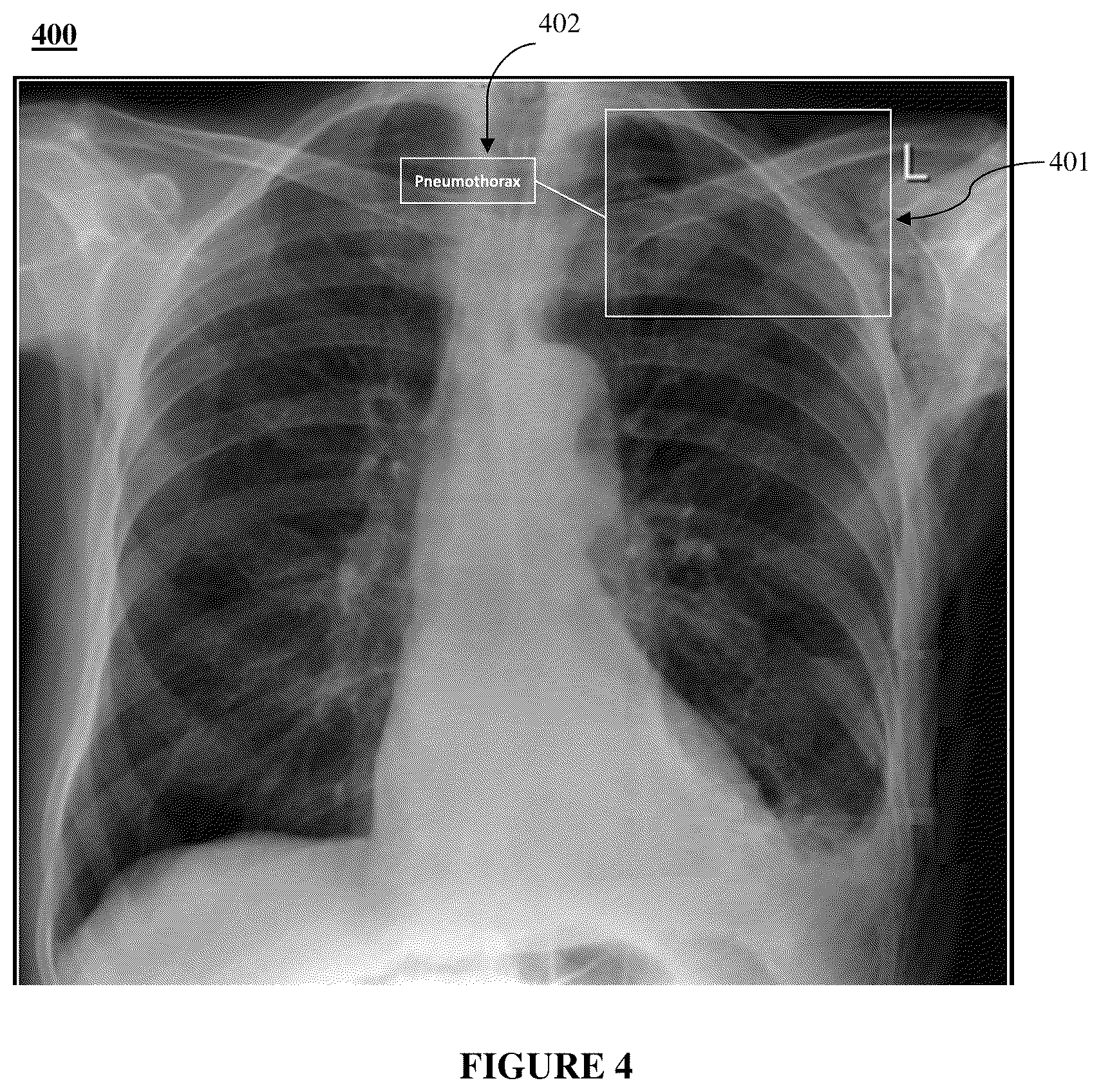 Patent US12620477 Figure 4 – System and method for detecting lung abnormalities in a medical image