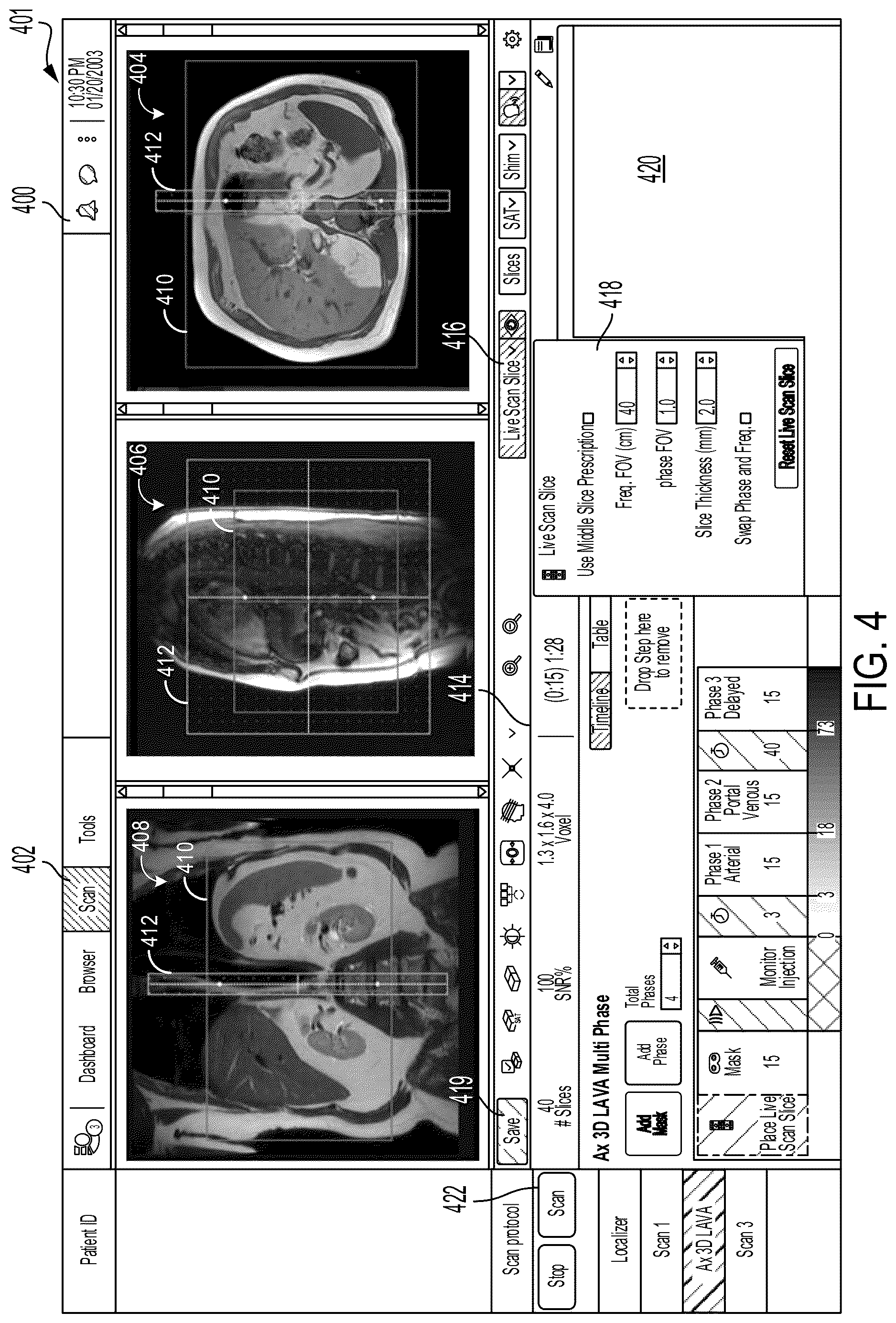 Patent US12620483 Figure 4 – Systems and methods for contrast imaging