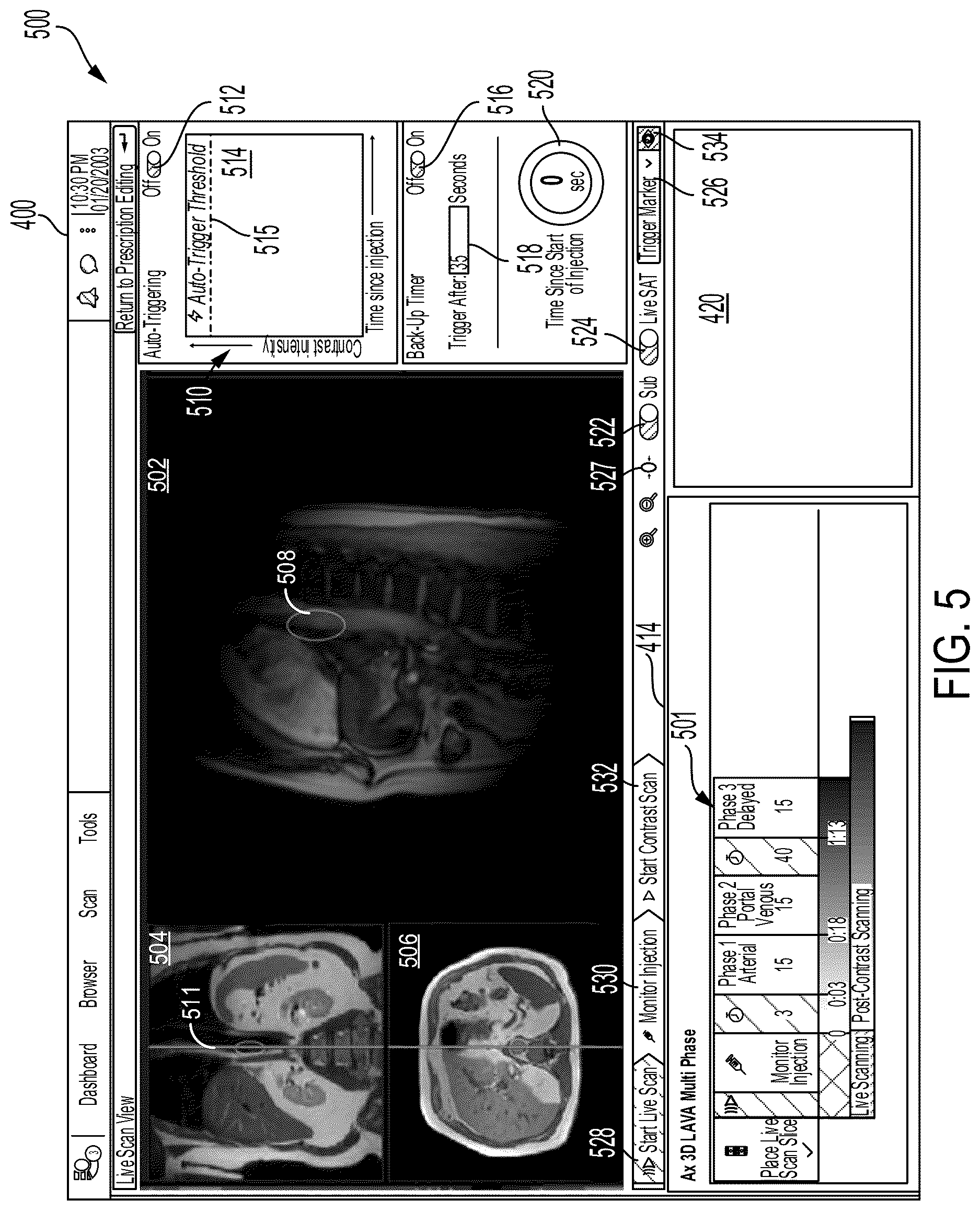 Patent US12620483 Figure 5 – Systems and methods for contrast imaging
