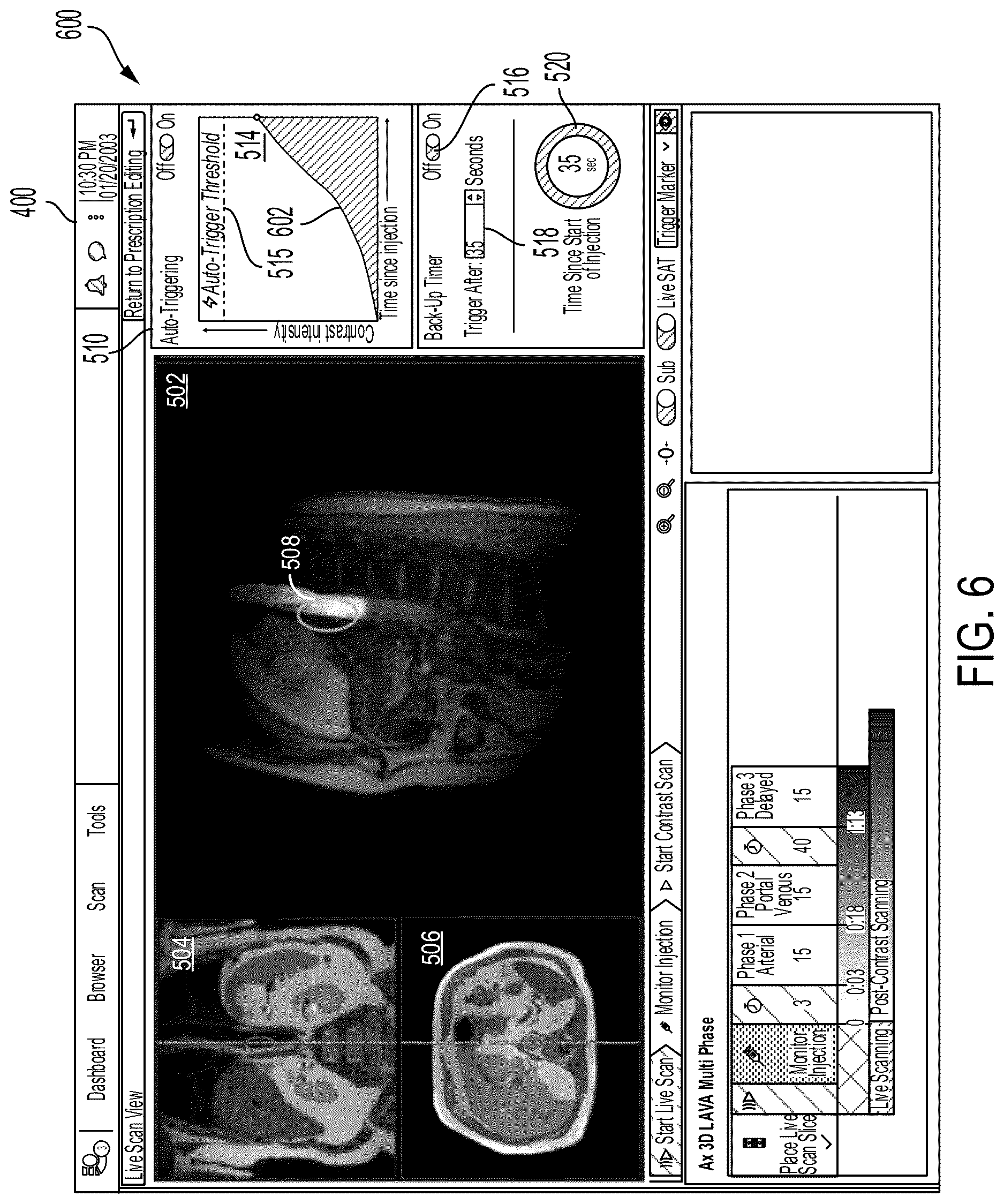 Patent US12620483 Figure 6 – Systems and methods for contrast imaging