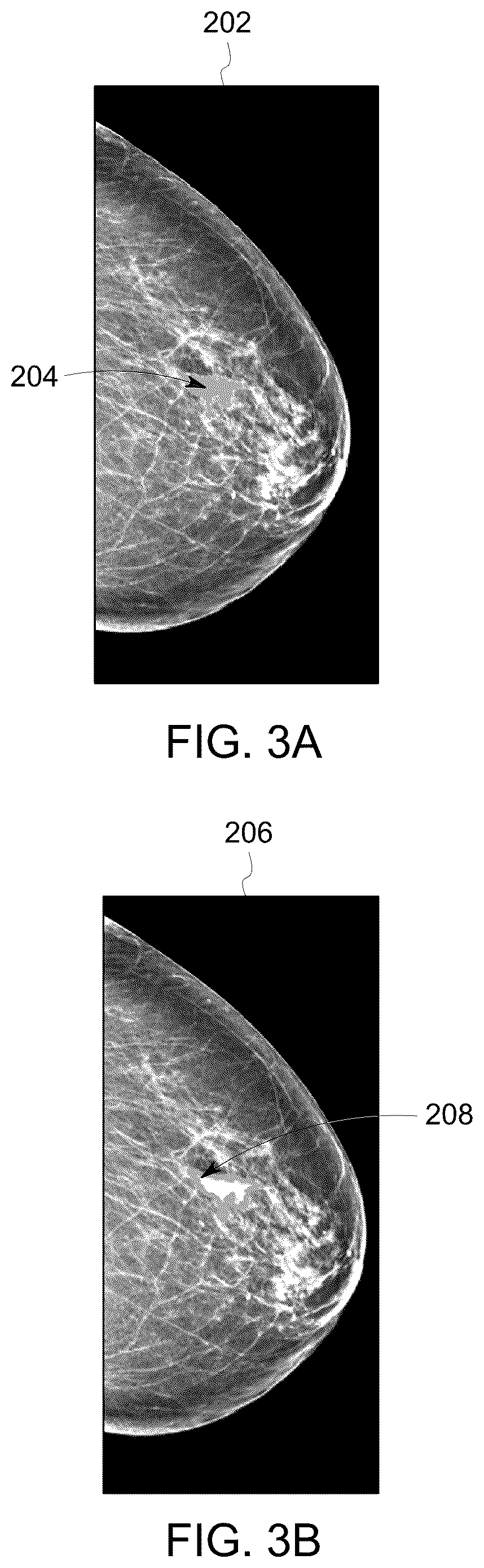 Patent US12620490 Figure 3 – System and method for detecting recurrence of a disease
