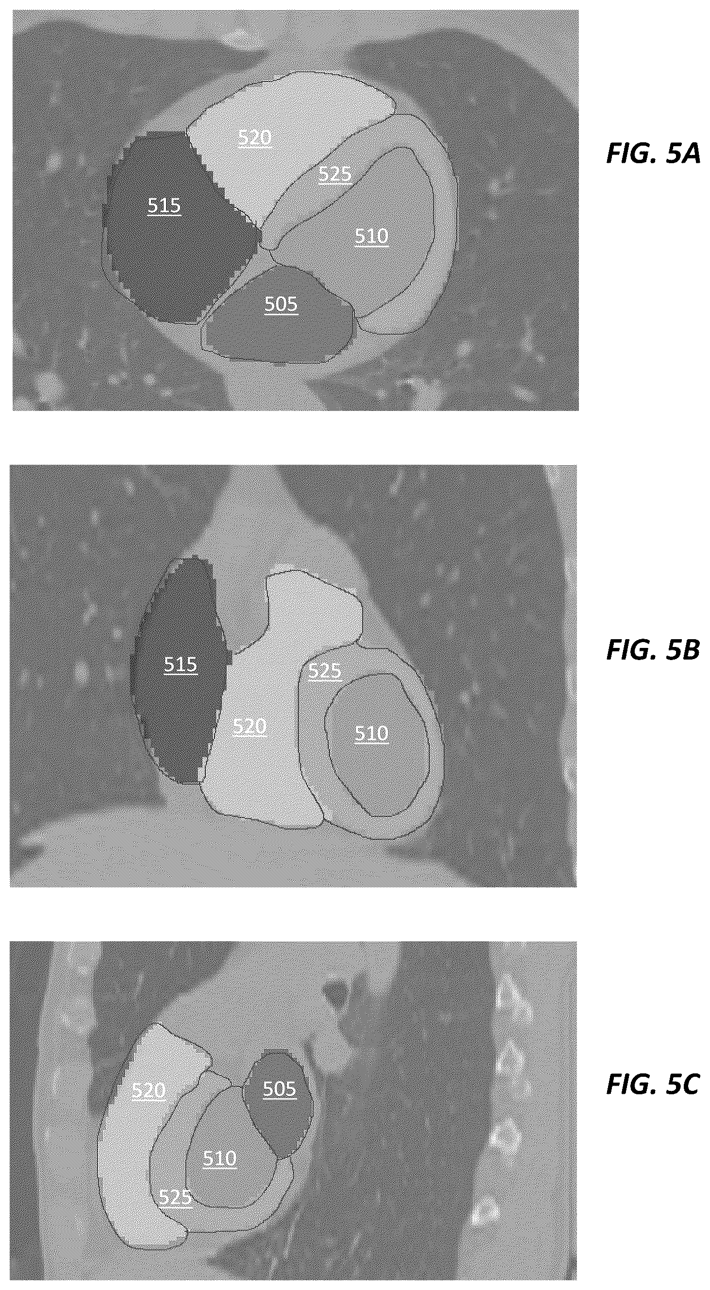 Patent US12620494 Figure 3 – Predicting adverse health risk based on CT scan images and AI-enabled cardiovascular structure volumetry