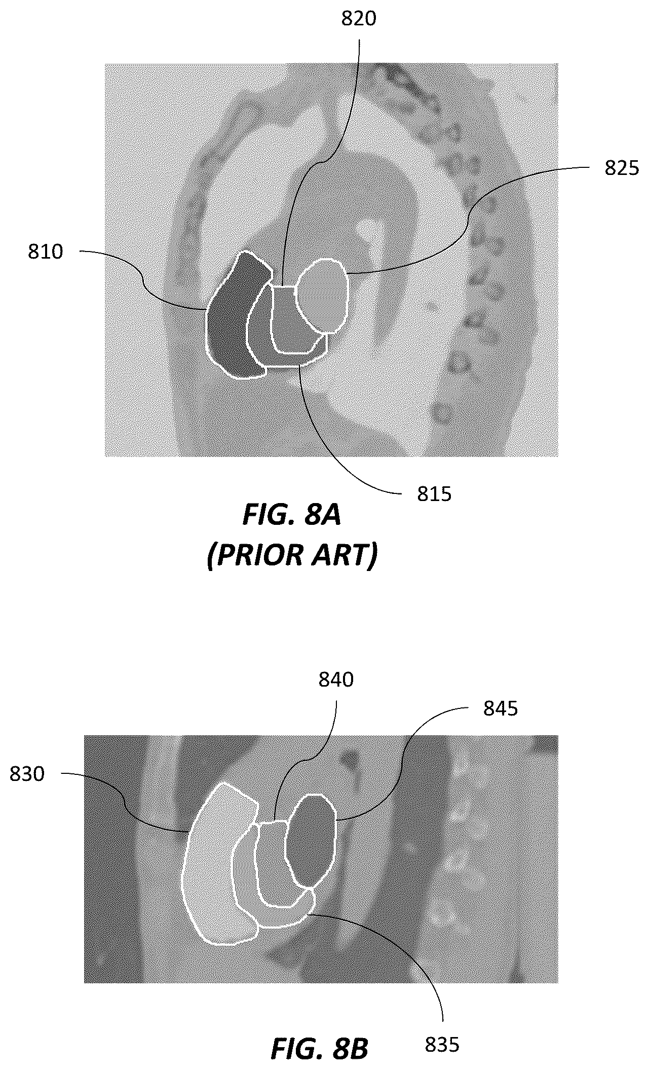 Patent US12620494 Figure 6 – Predicting adverse health risk based on CT scan images and AI-enabled cardiovascular structure volumetry