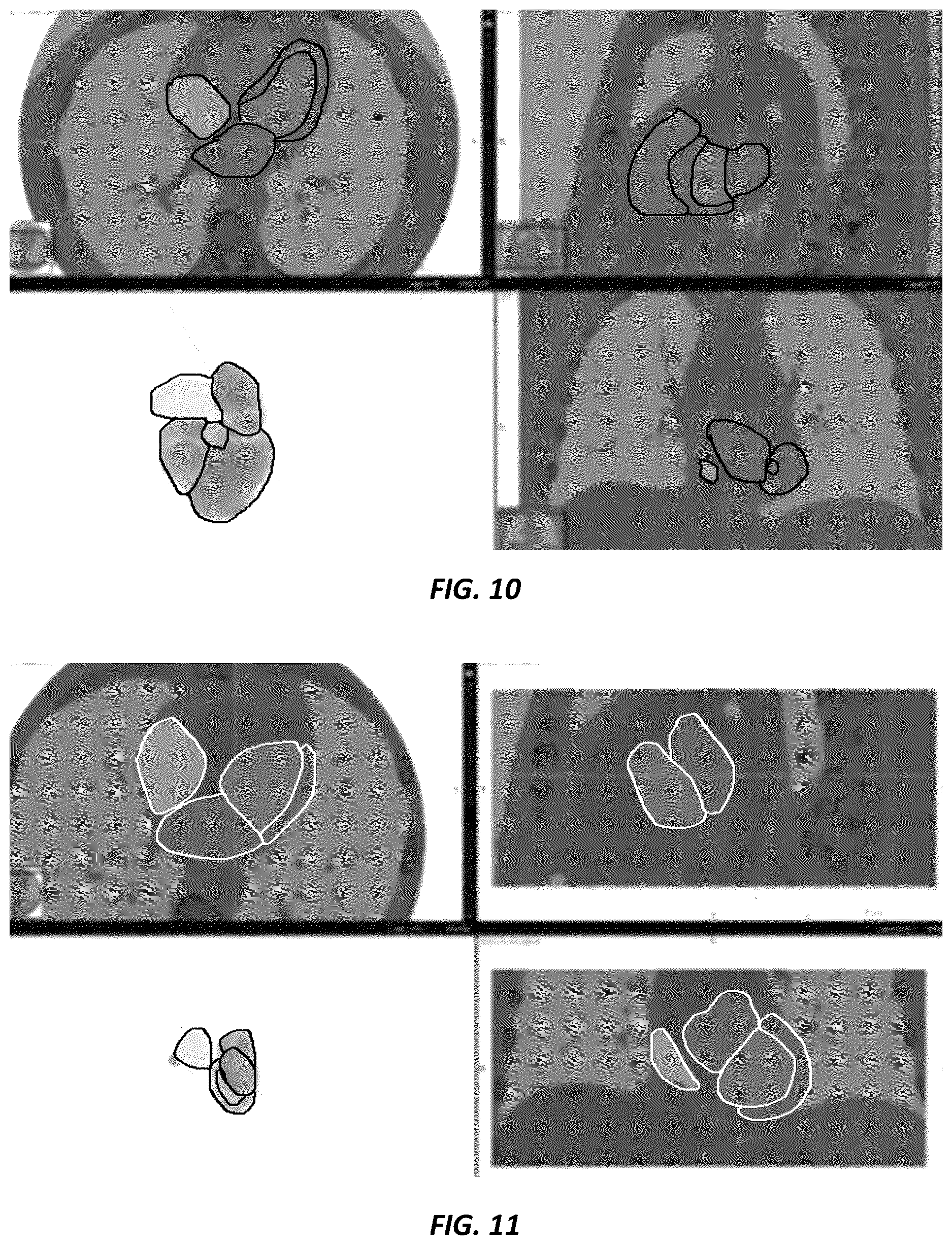 Patent US12620494 Figure 8 – Predicting adverse health risk based on CT scan images and AI-enabled cardiovascular structure volumetry