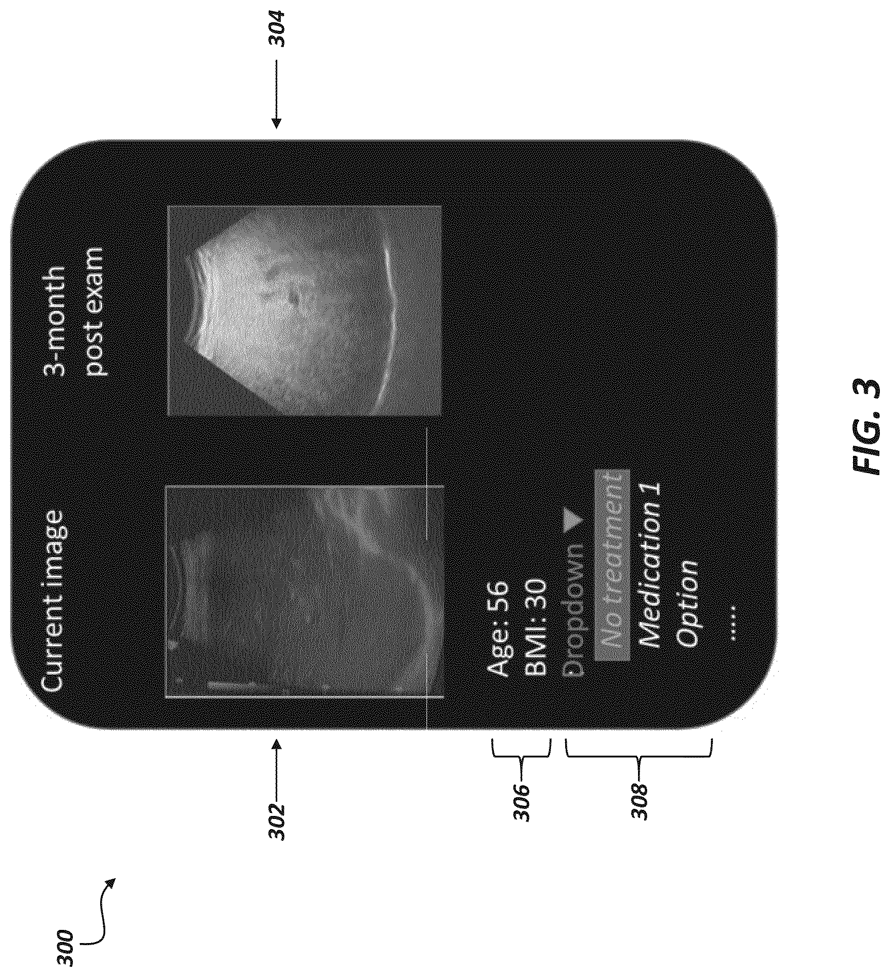 Patent US12620497 Figure 3 – Disease feature recognition in diagnostic images and disease progression prediction