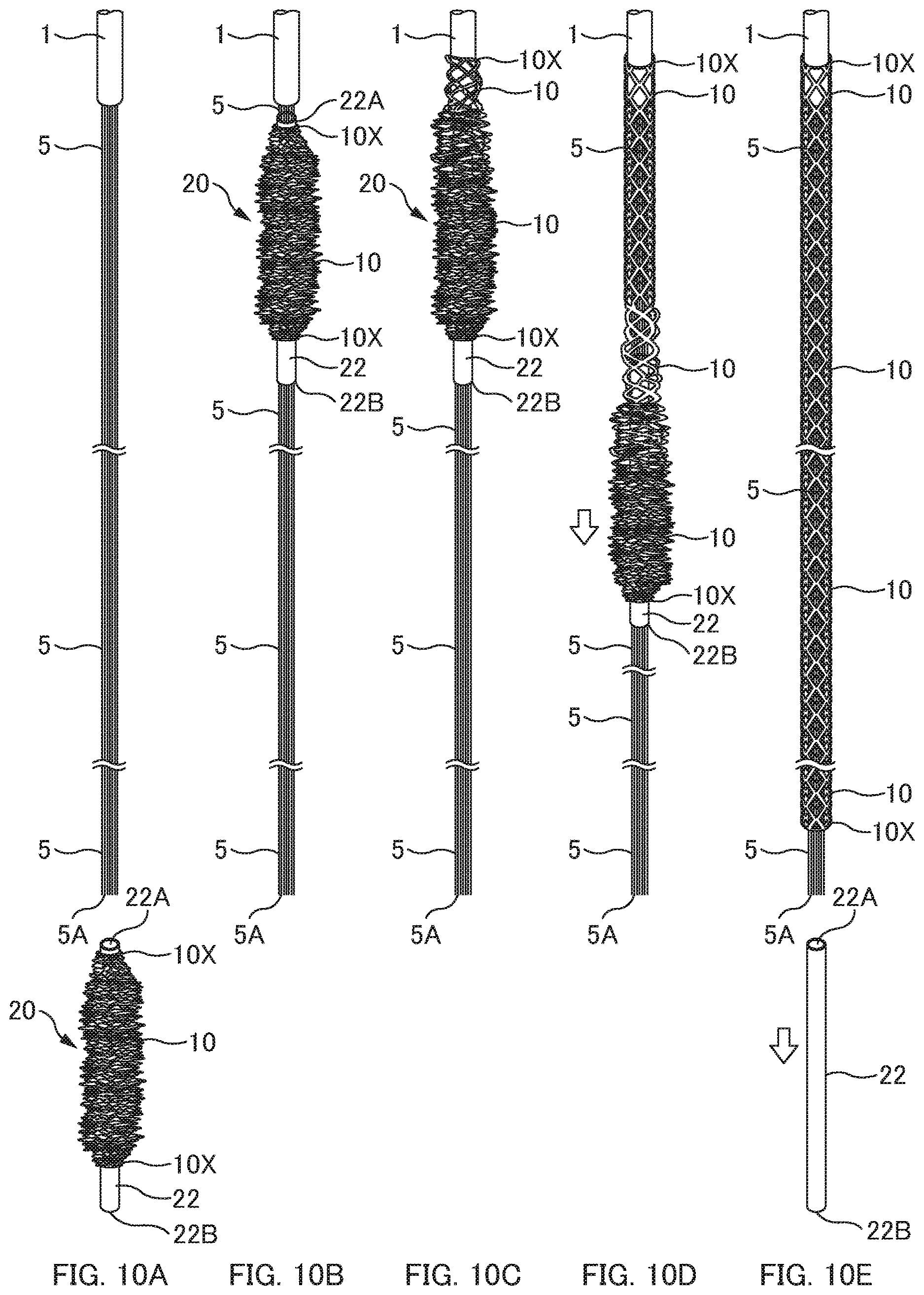 Patent US12620790 Figure 10 – Reticulated tube, optical fiber protective unit, method for protecting optical fiber, and method for manufacturing reticulated tube
