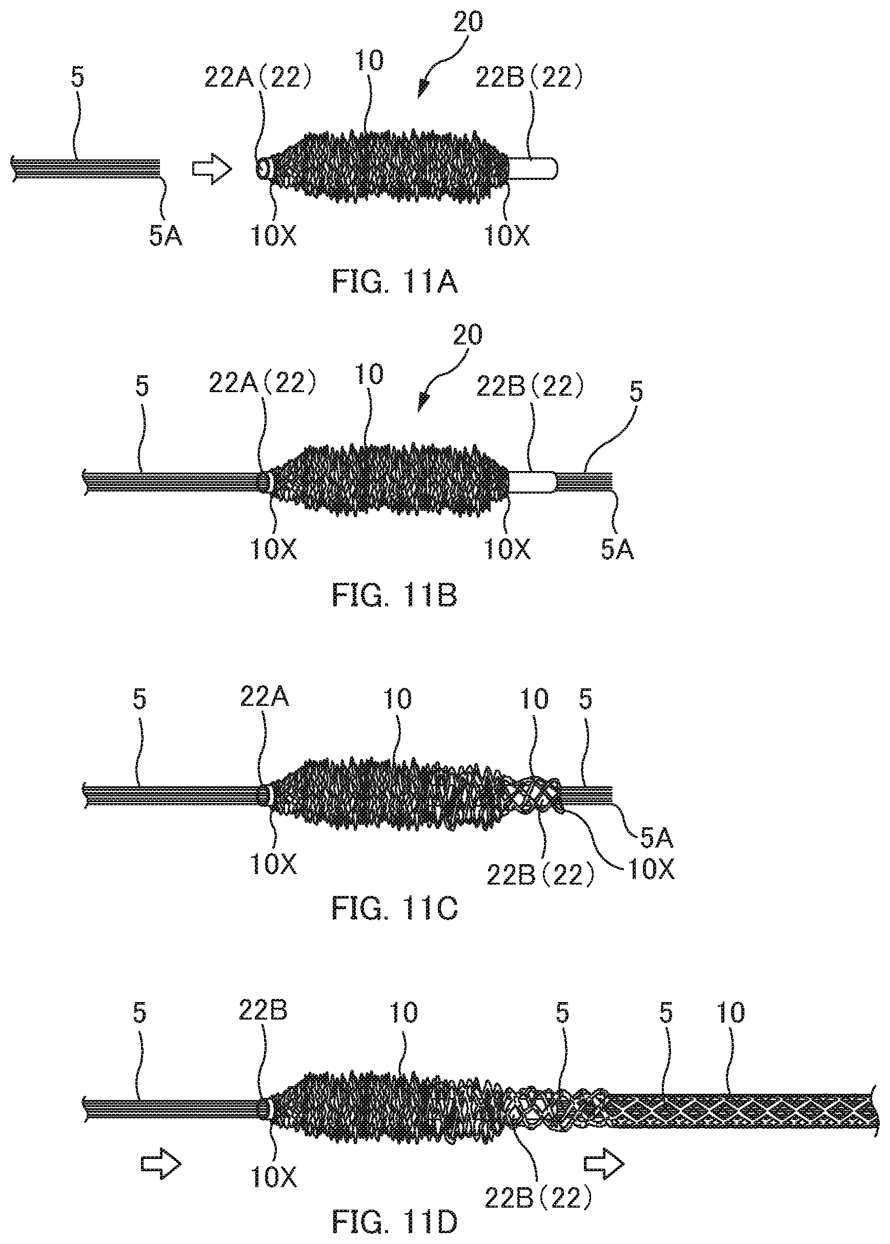 Patent US12620790 Figure 11 – Reticulated tube, optical fiber protective unit, method for protecting optical fiber, and method for manufacturing reticulated tube
