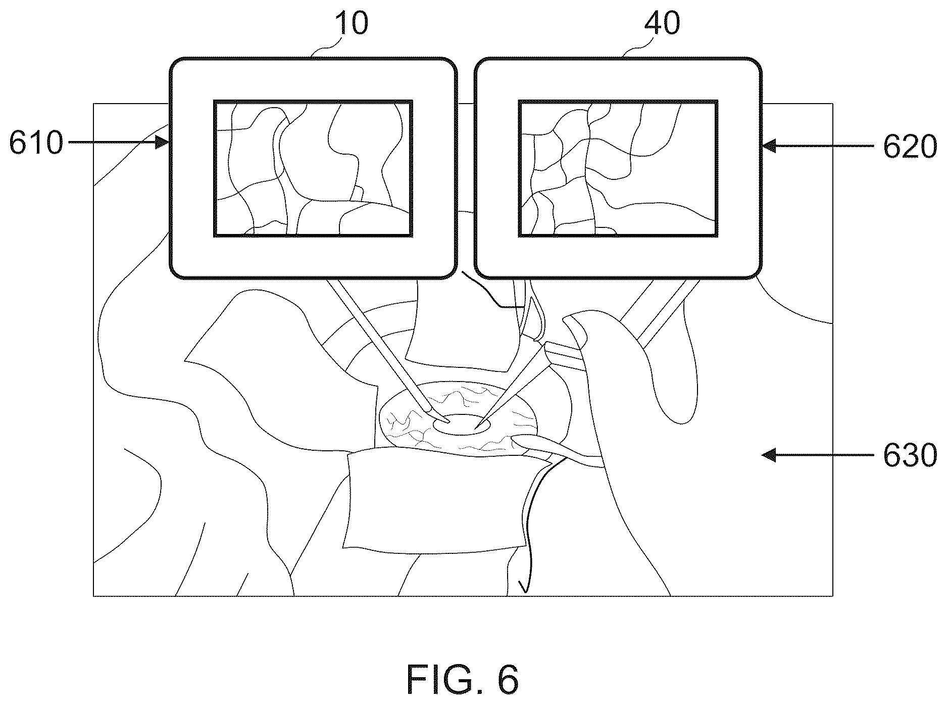 Patent US12621426 Figure 6 – Head-mountable display device and method for displaying an image received from a microscope