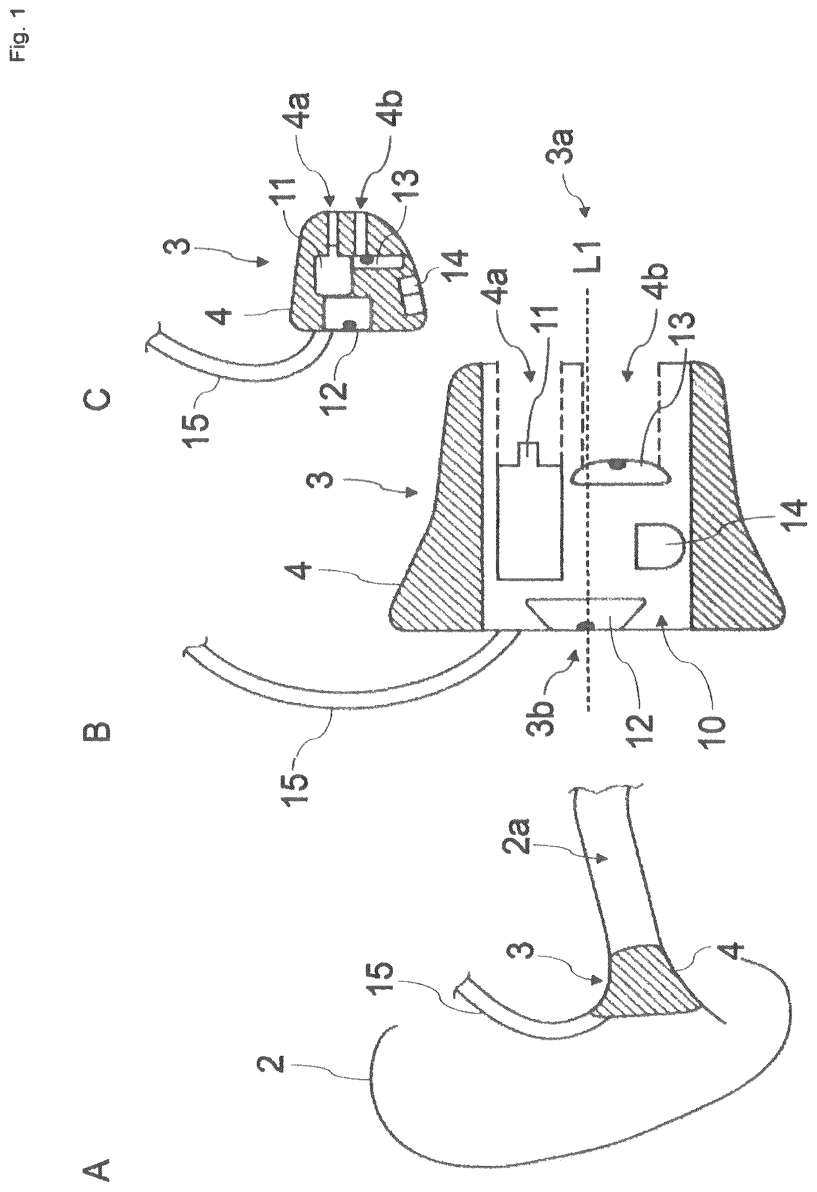 Patent US12621596 Figure 1 – Ear worn device