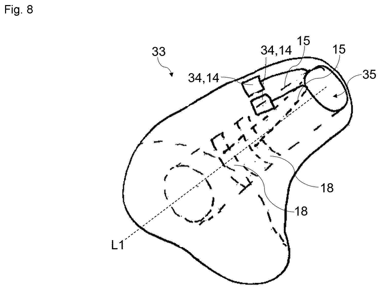 Patent US12621596 Figure 7 – Ear worn device