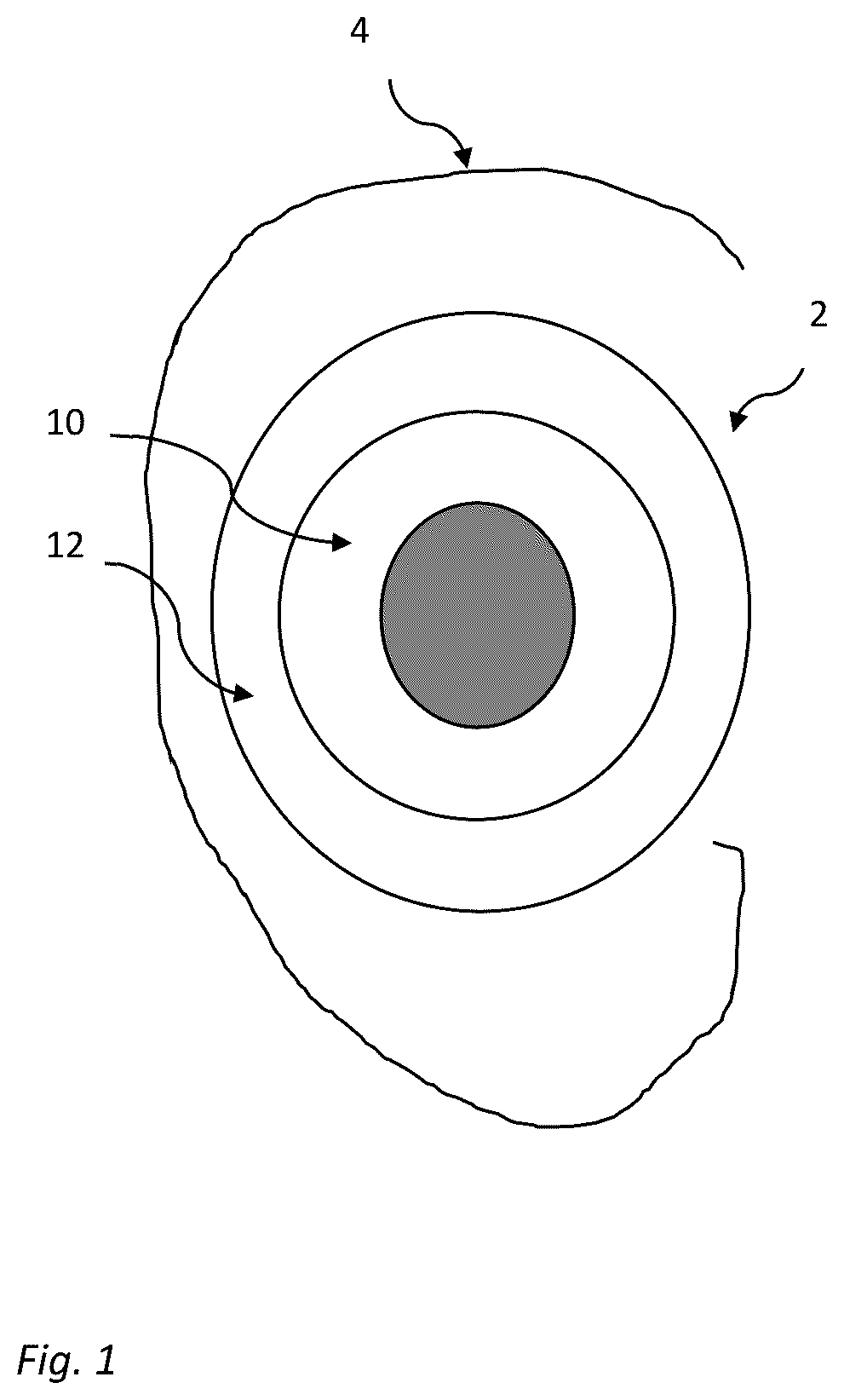 Patent US12621599 Figure 1 – On-the-ear ear cushion with multiple foams having different properties