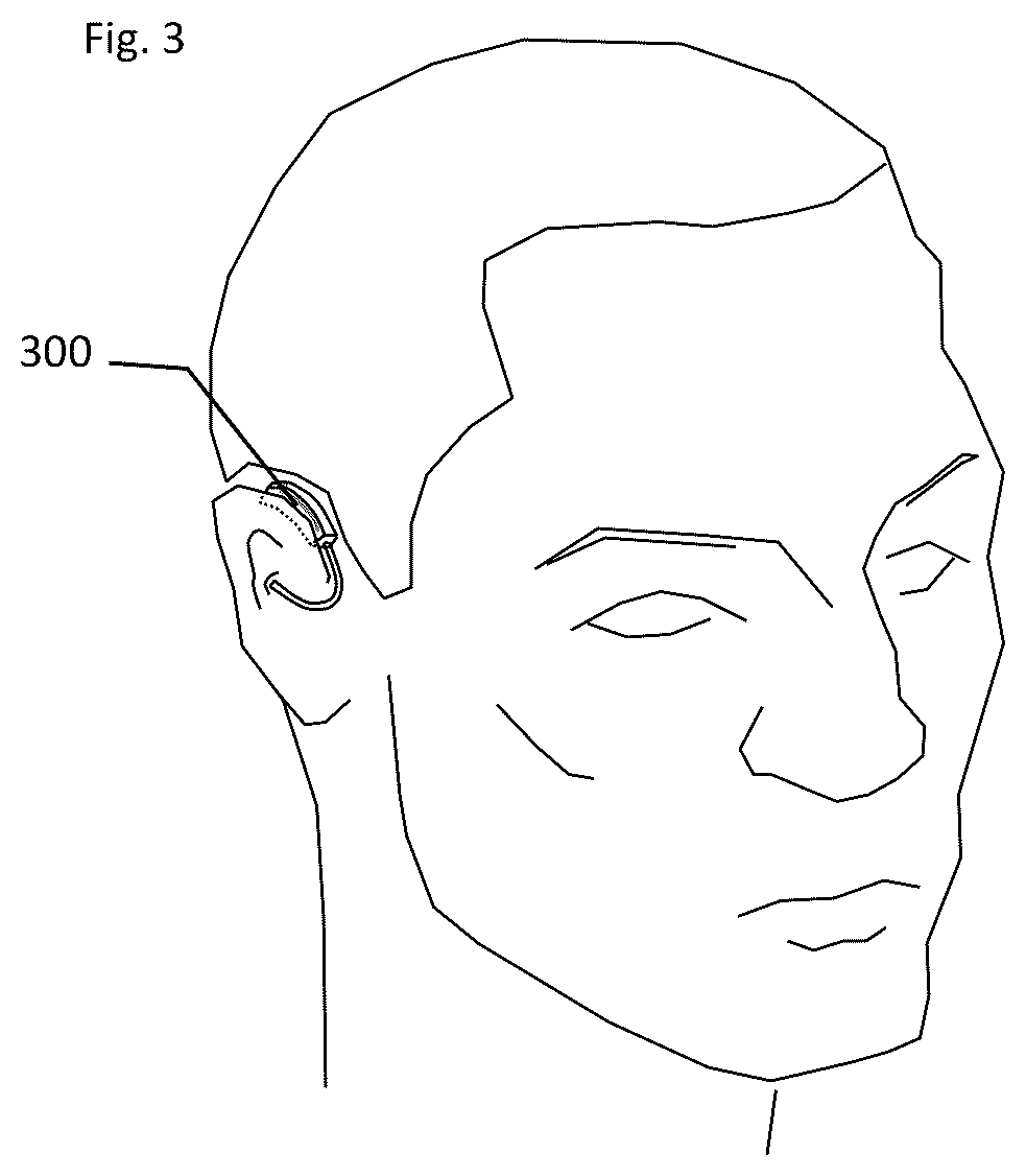 Patent US12621600 Figure 4 – Speaker device with bistable active vent