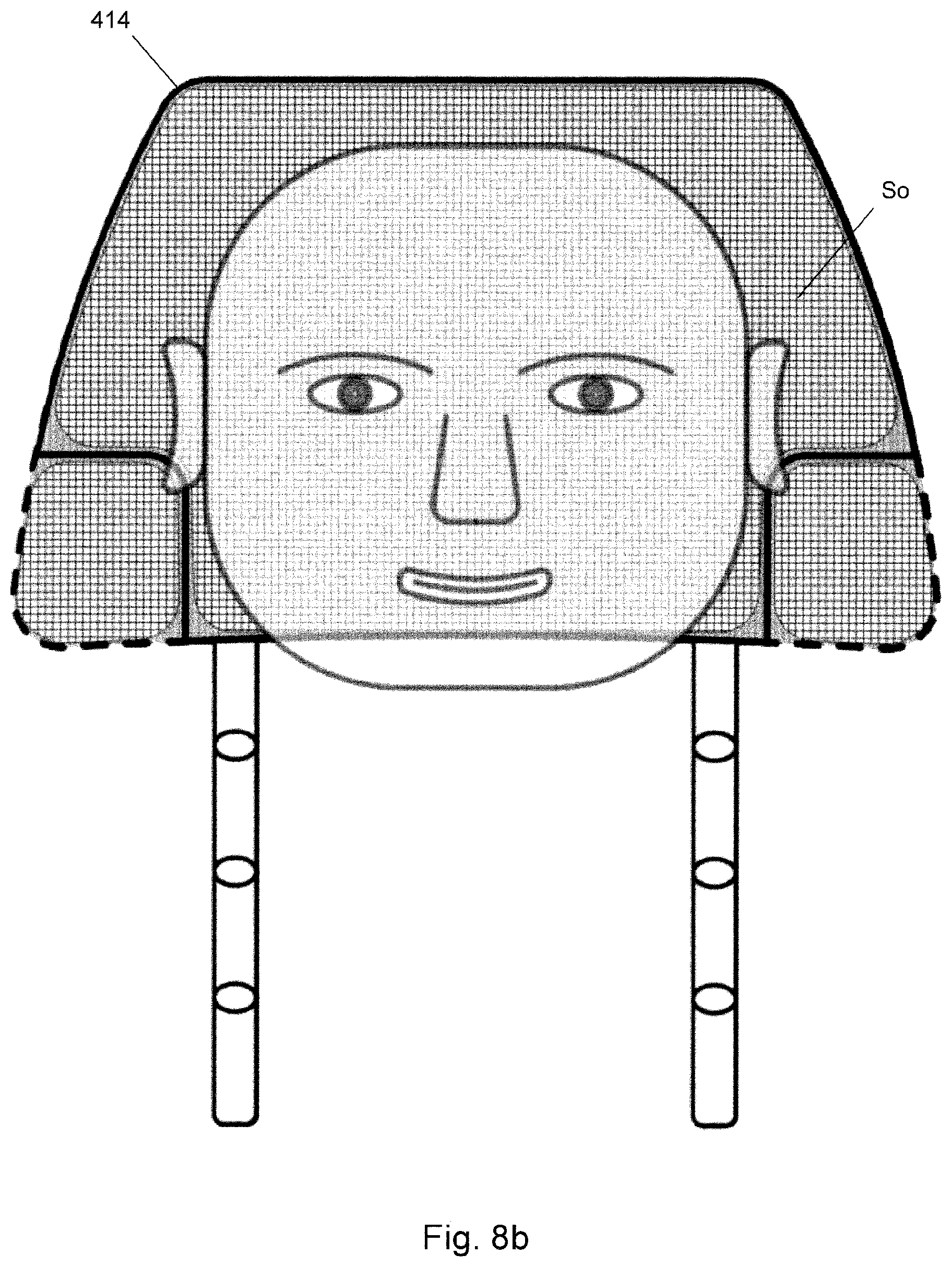 Patent US12621602 Figure 11 – Loudspeaker assembly for headrest