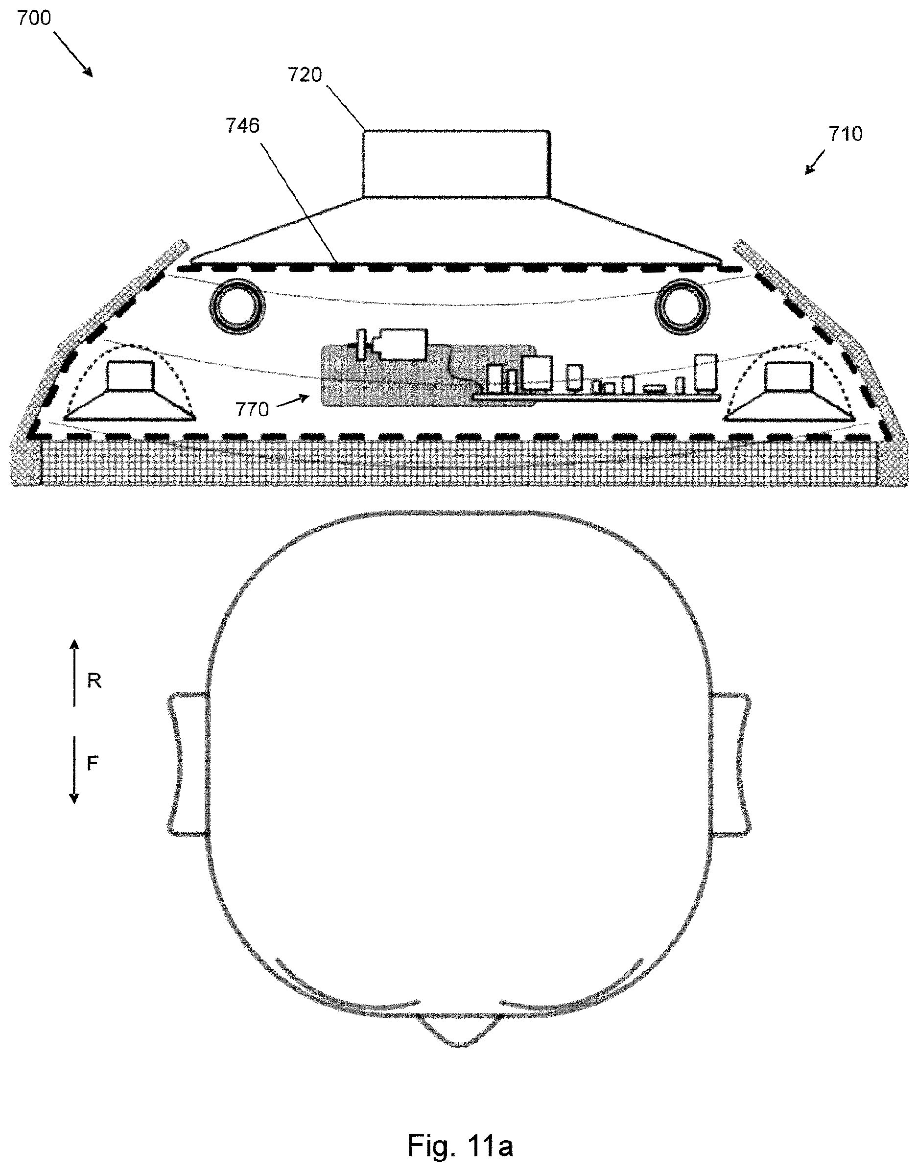 Patent US12621602 Figure 16 – Loudspeaker assembly for headrest