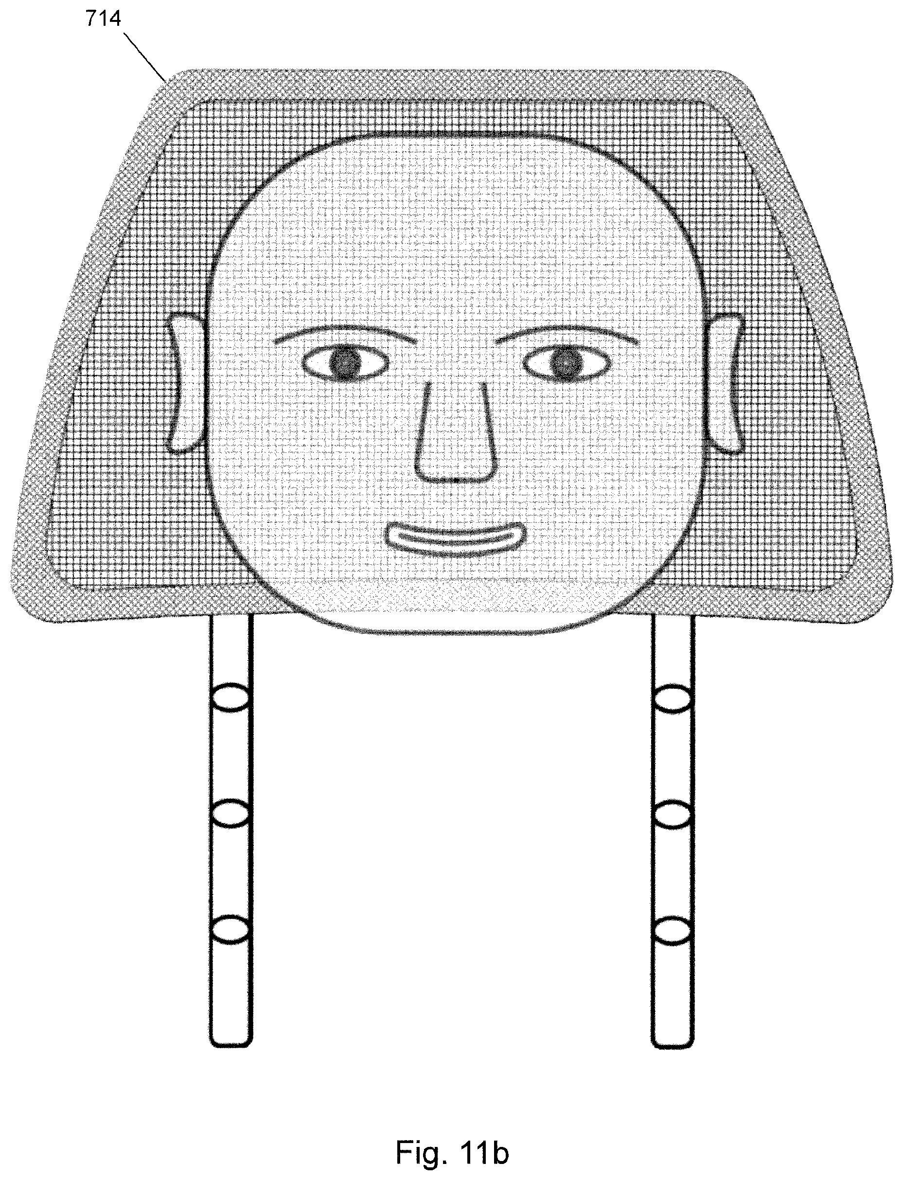 Patent US12621602 Figure 17 – Loudspeaker assembly for headrest